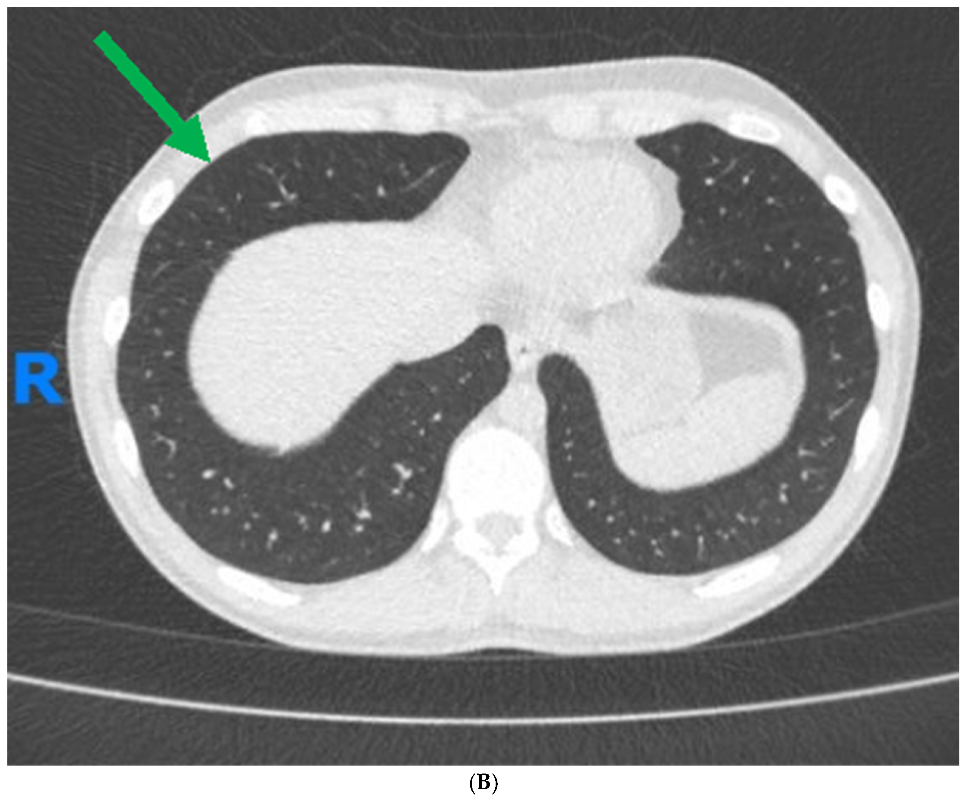 Jcm 13 05401 g001b Jcm 13 05401 g001b