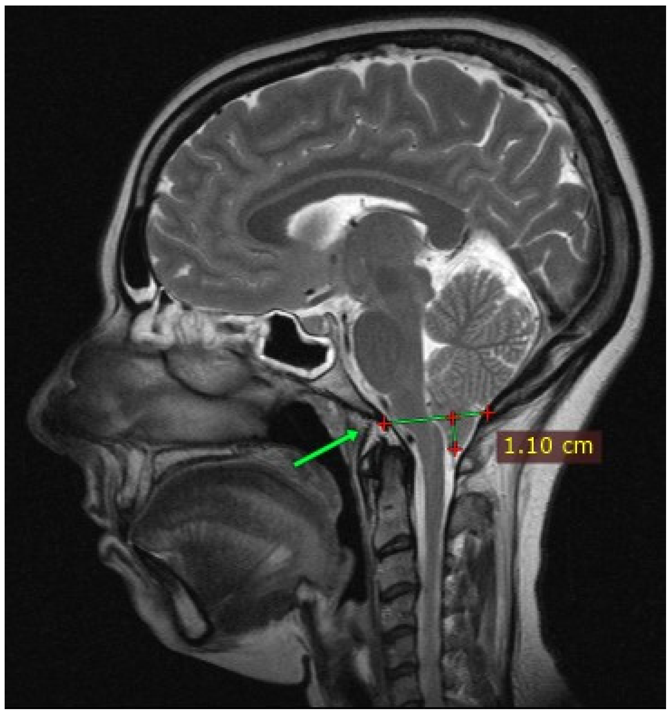 Jcm 13 05502 g001 Jcm 13 05502 g001