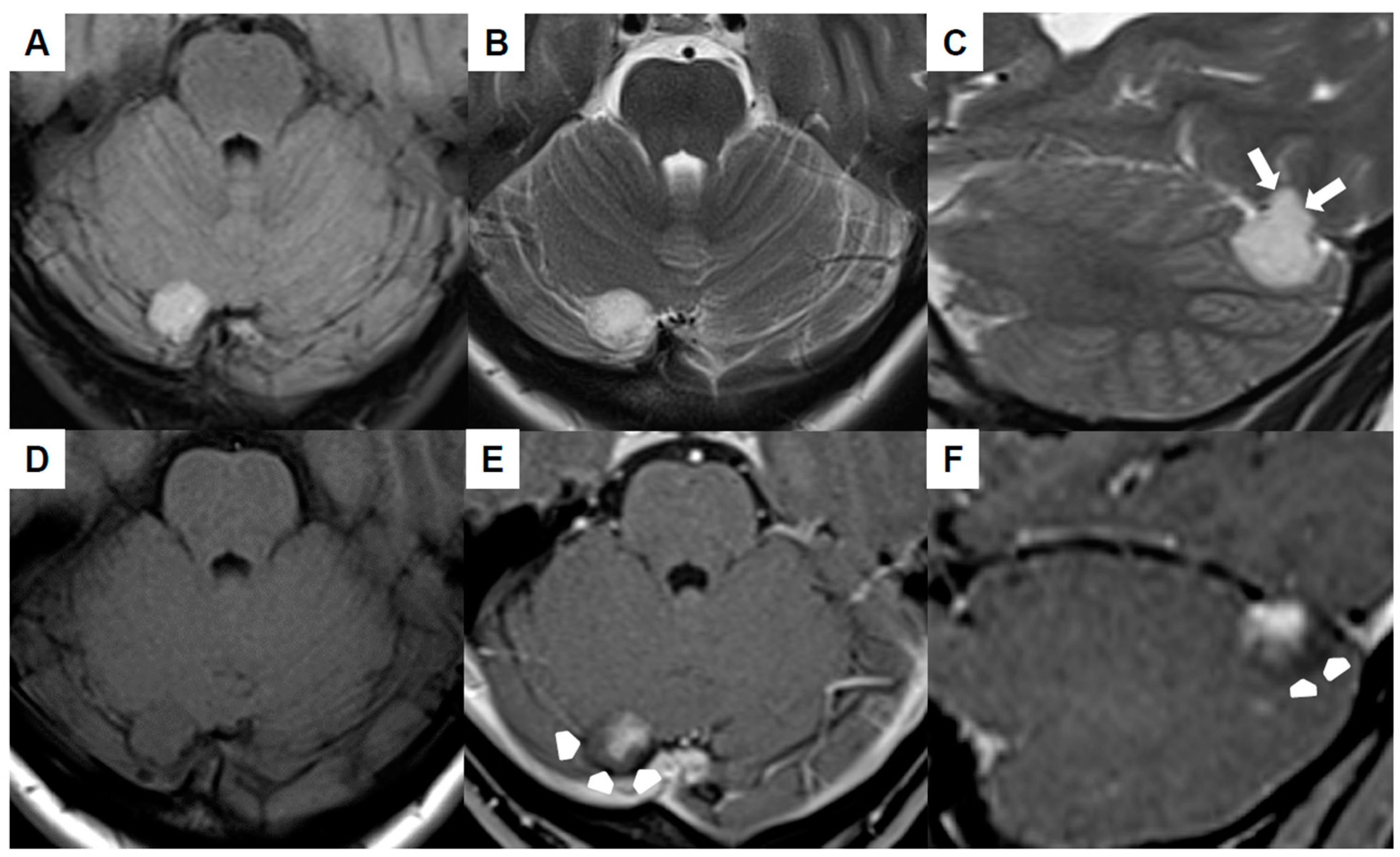 Jcm 13 05813 g001 Jcm 13 05813 g001