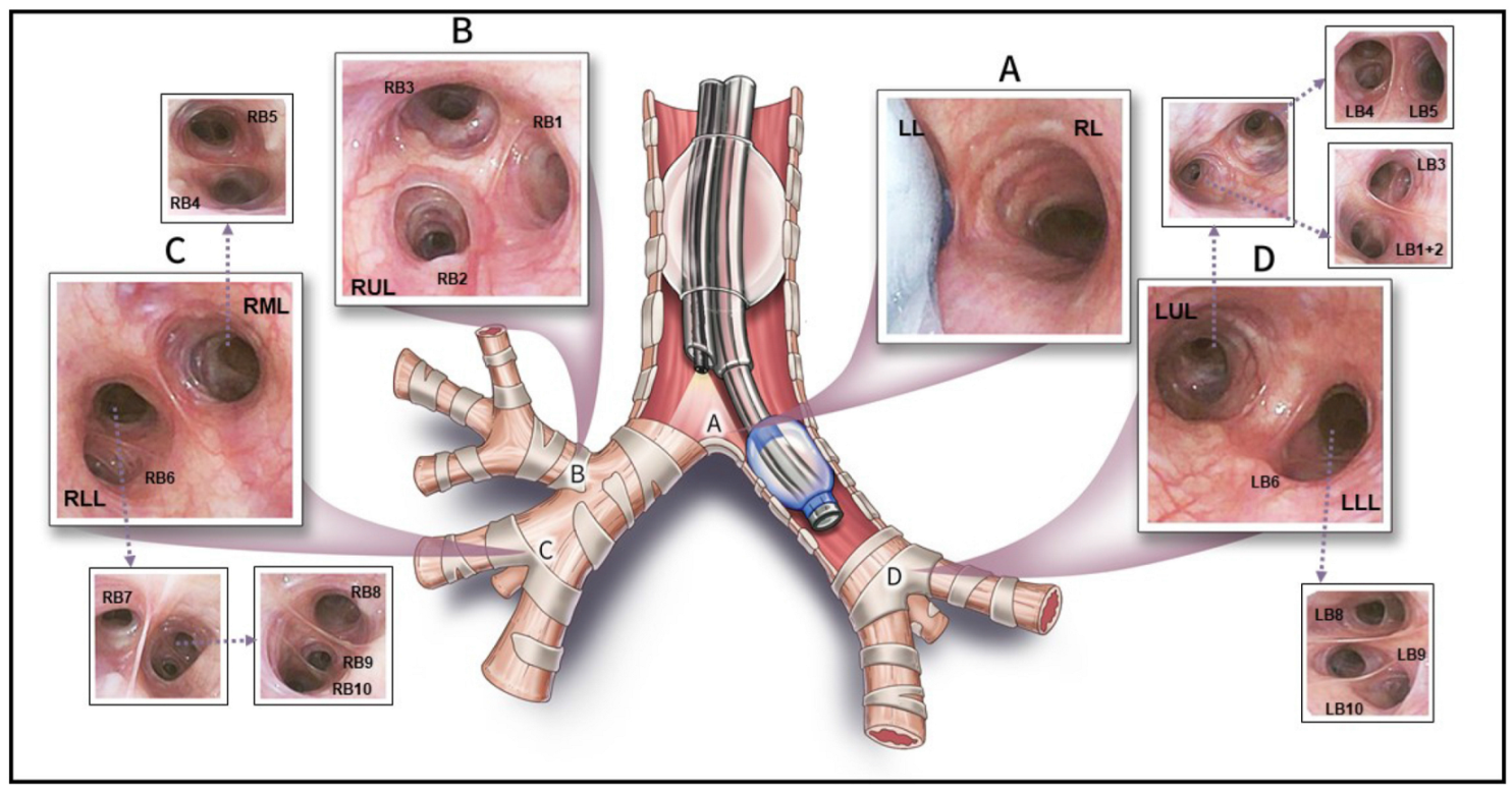 Jcm 13 06020 g002 Jcm 13 06020 g002