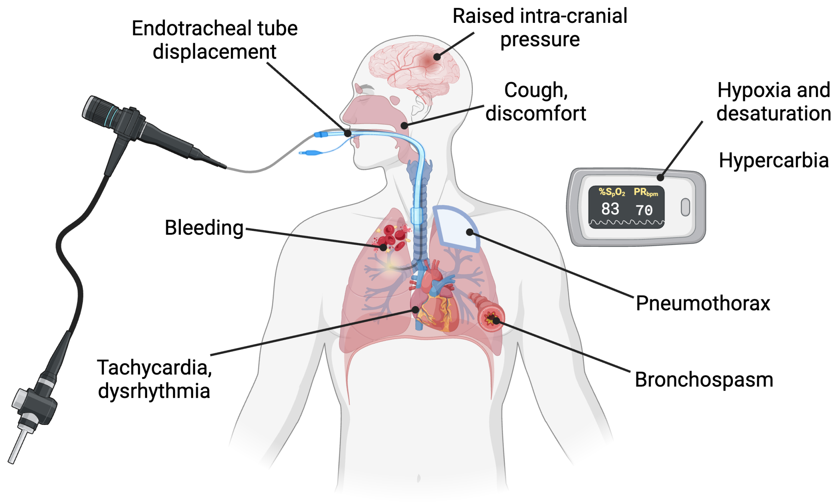 Jcm 13 06020 g003 Jcm 13 06020 g003
