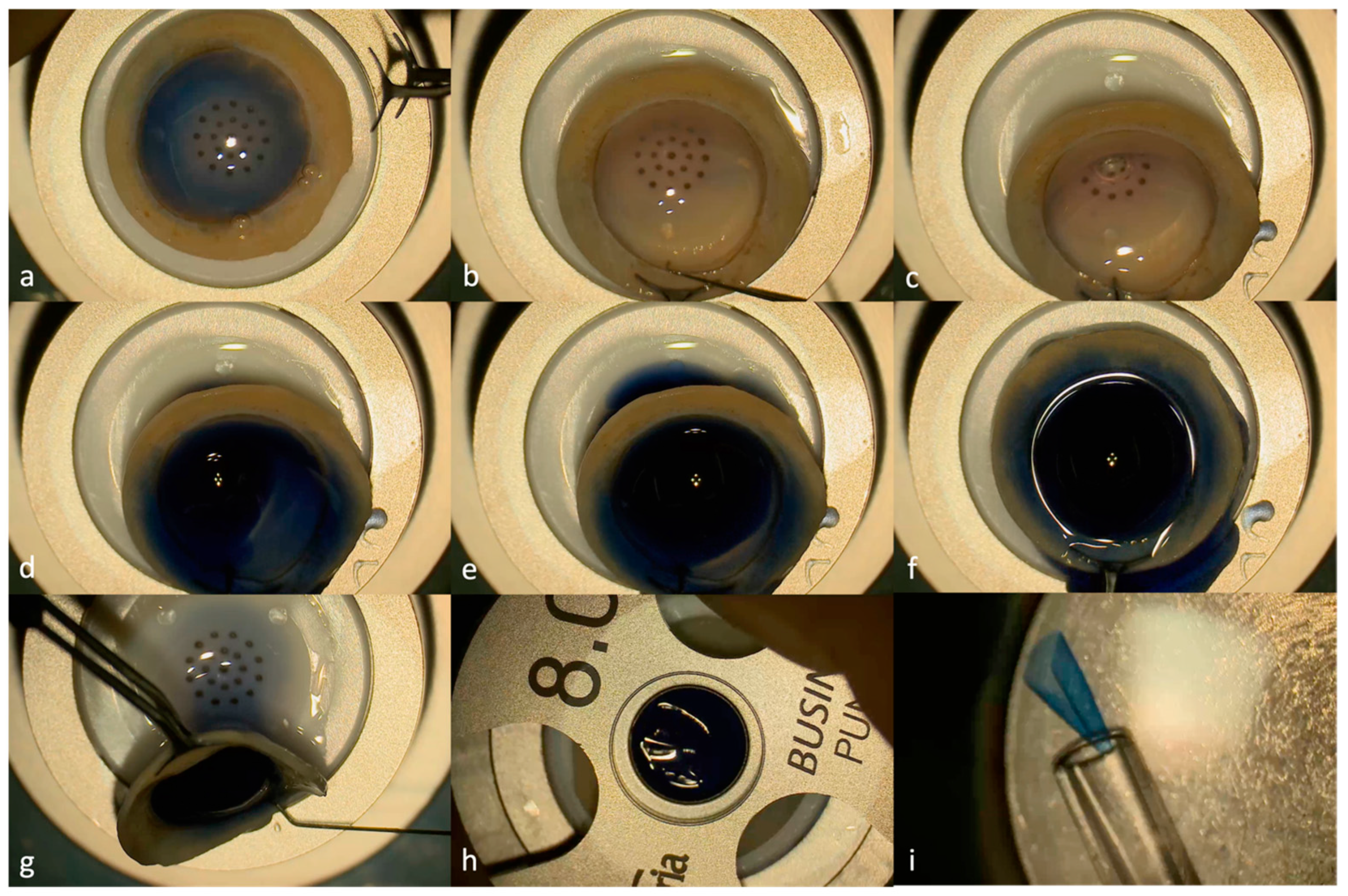 Jcm 13 06048 g001 Jcm 13 06048 g001