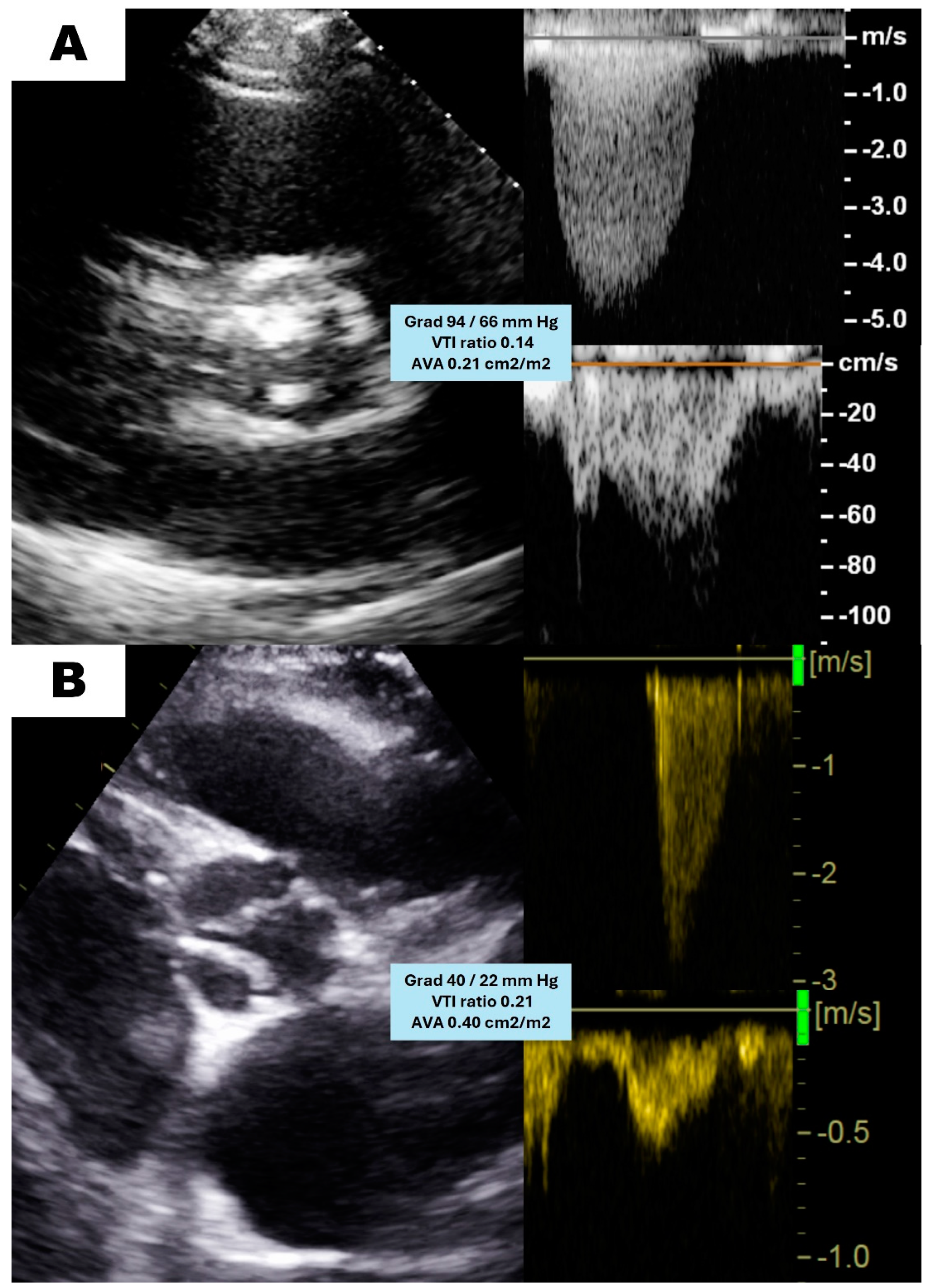 Jcm 13 06113 g002 Jcm 13 06113 g002