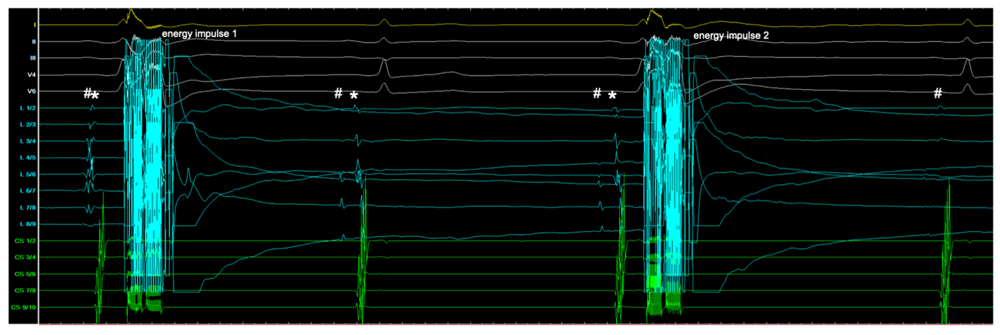 Jcm 13 07040 g003 Jcm 13 07040 g003