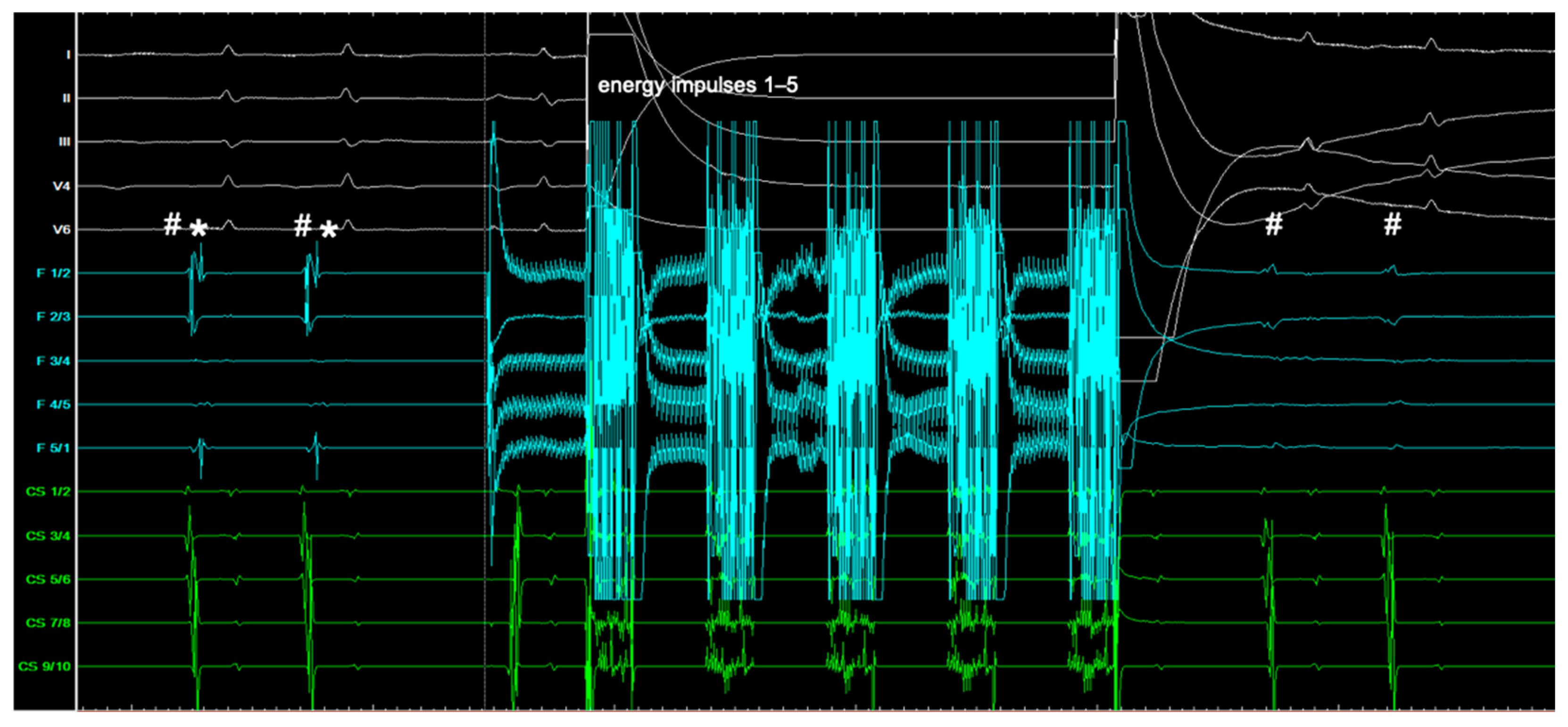 Jcm 13 07040 g006 Jcm 13 07040 g006