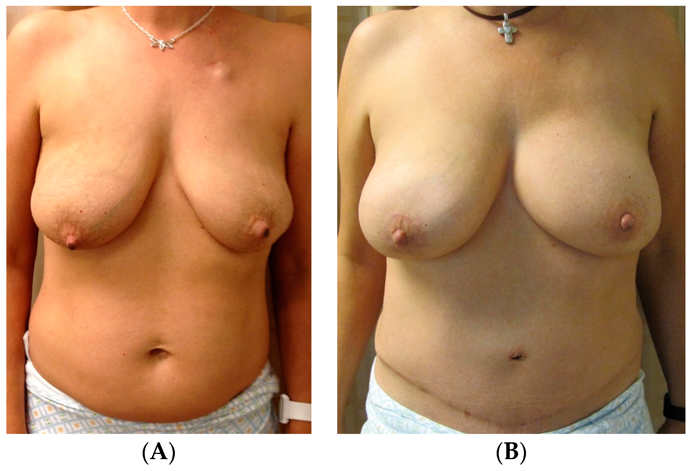 Jcm 13 07189 g005 Jcm 13 07189 g005