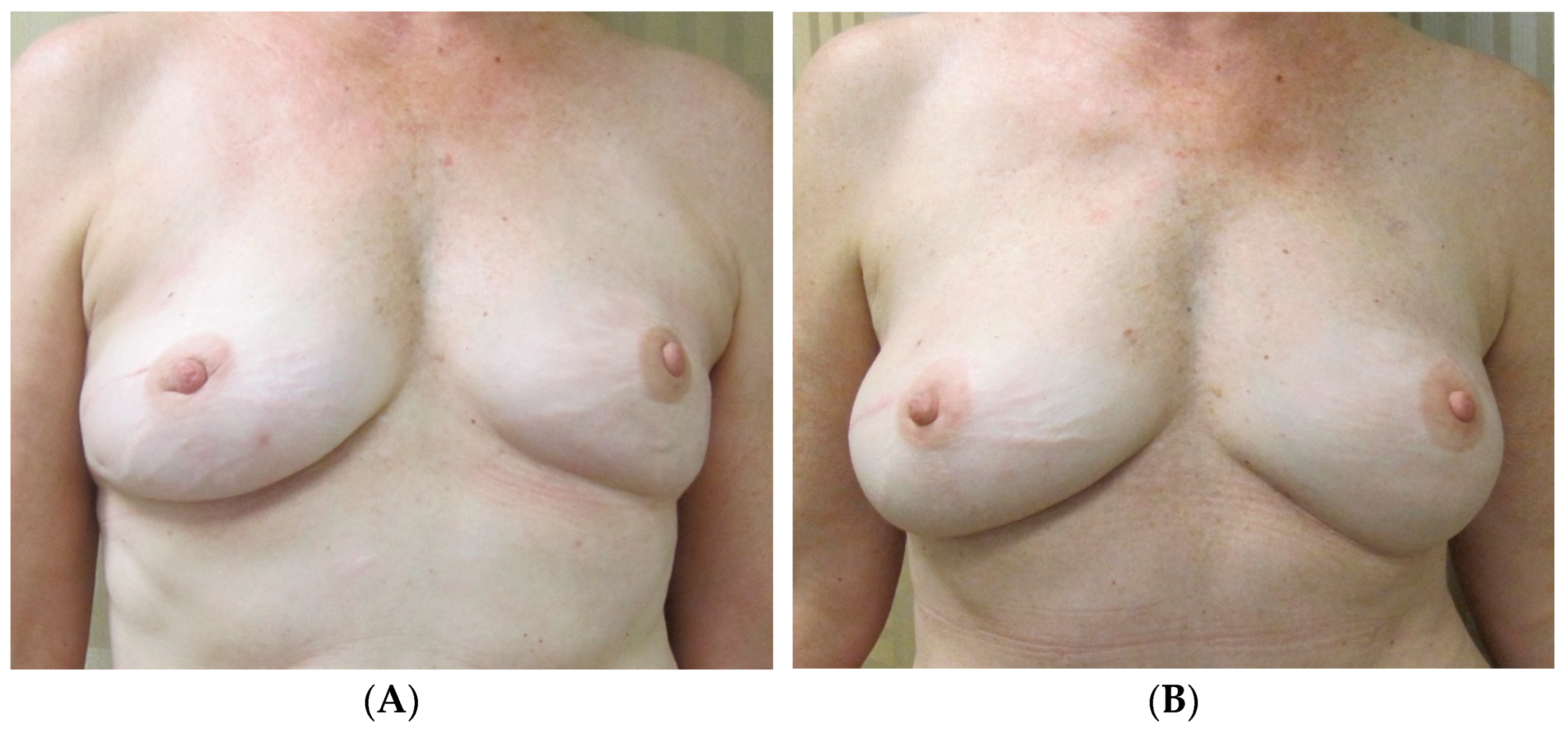 Jcm 13 07189 g006 Jcm 13 07189 g006