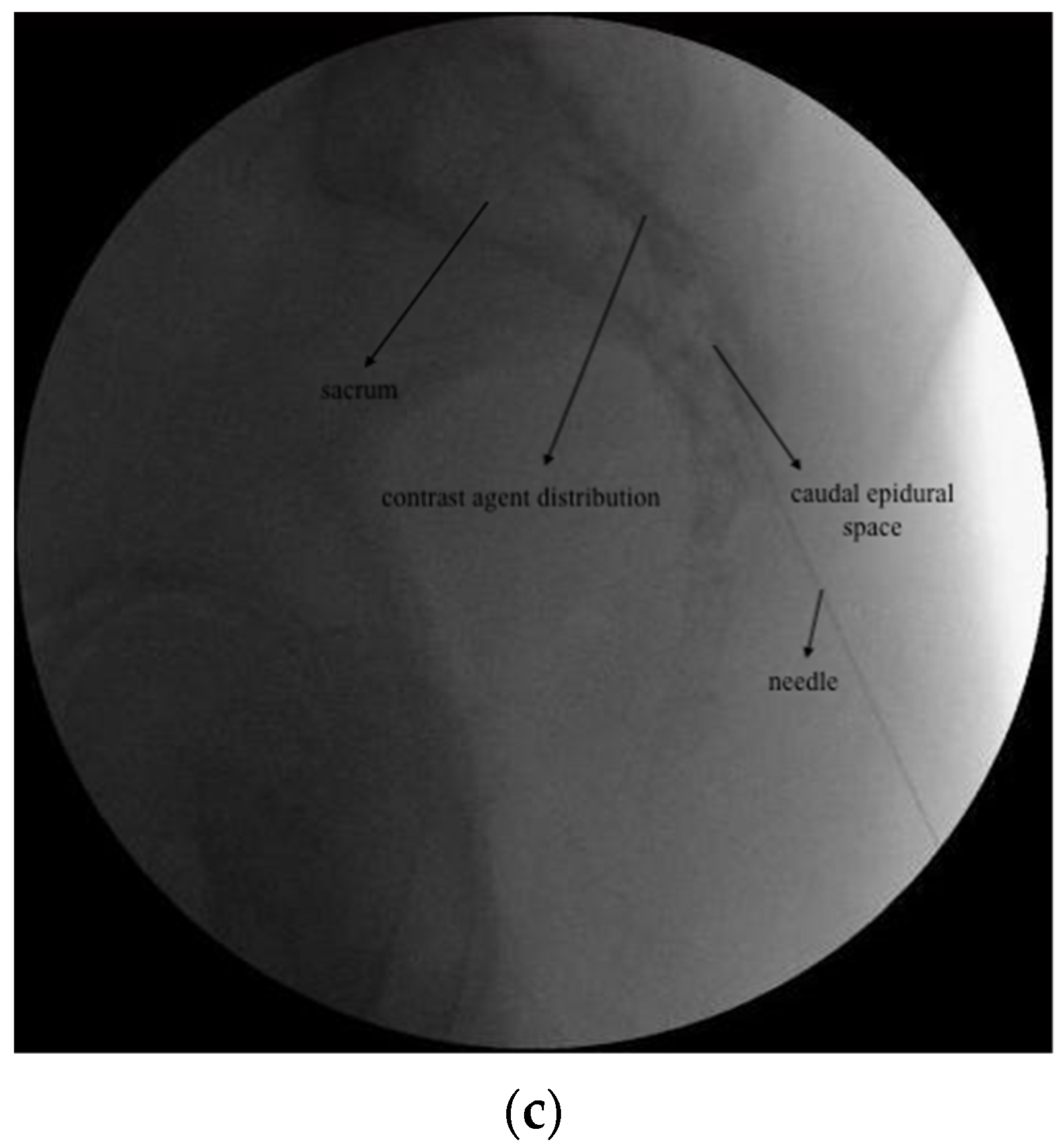Jcm 13 07821 g001b Jcm 13 07821 g001b