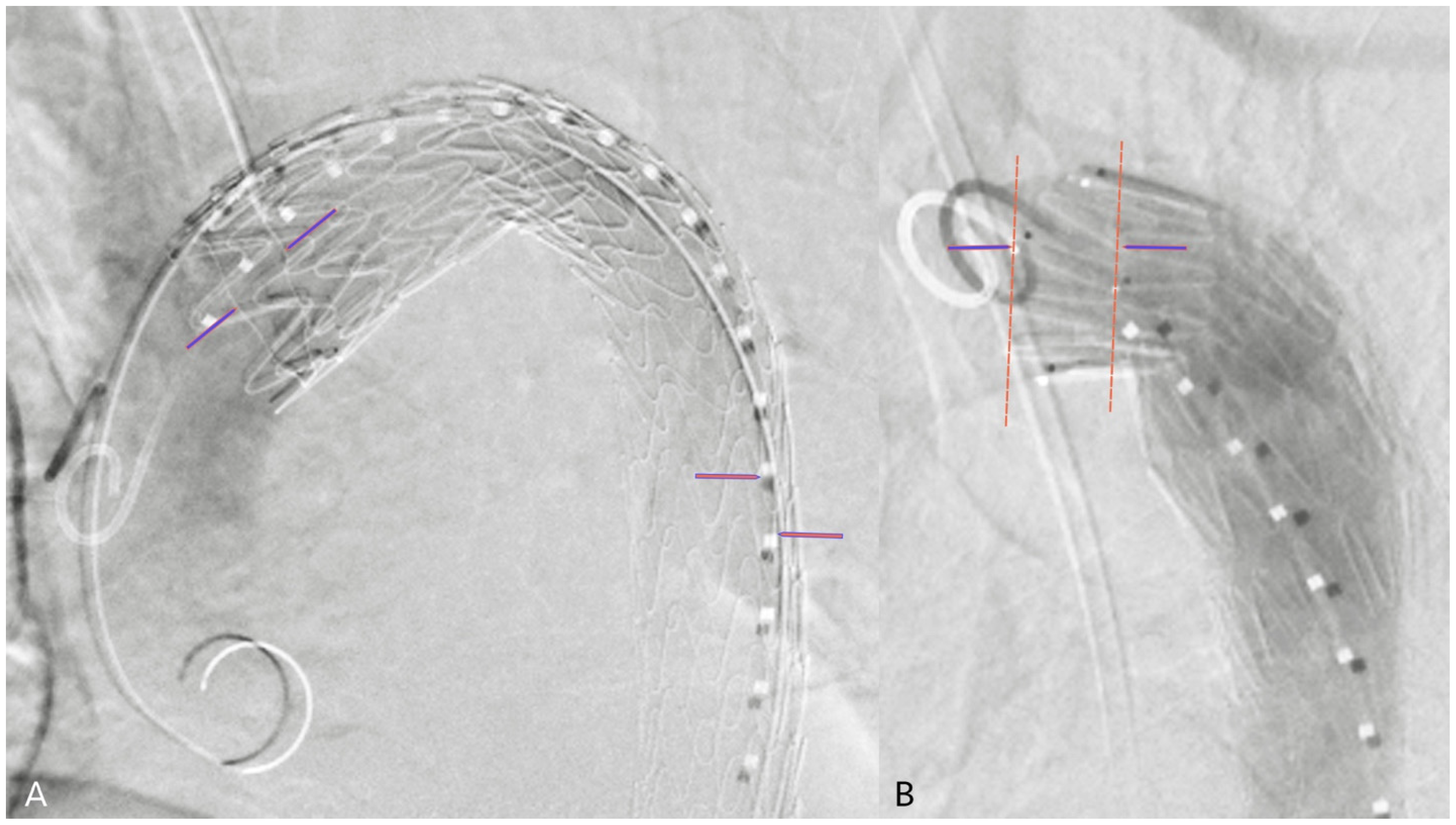 Jcm 14 00301 g001 Jcm 14 00301 g001