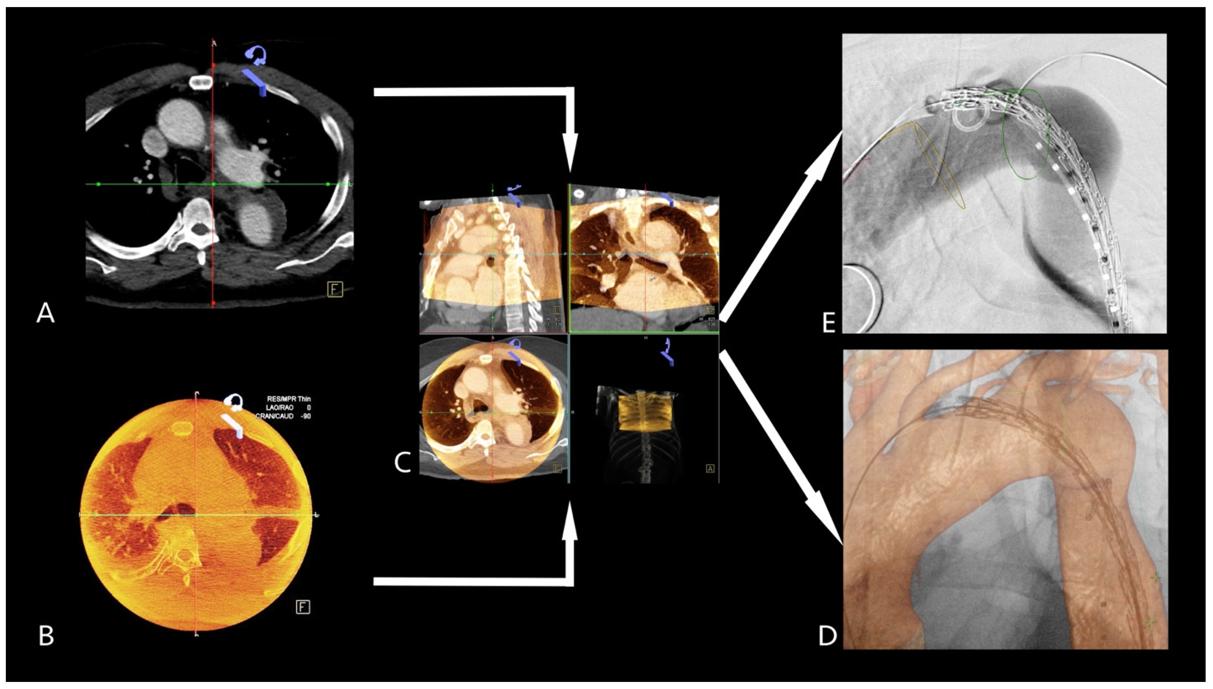 Jcm 14 00301 g004 Jcm 14 00301 g004