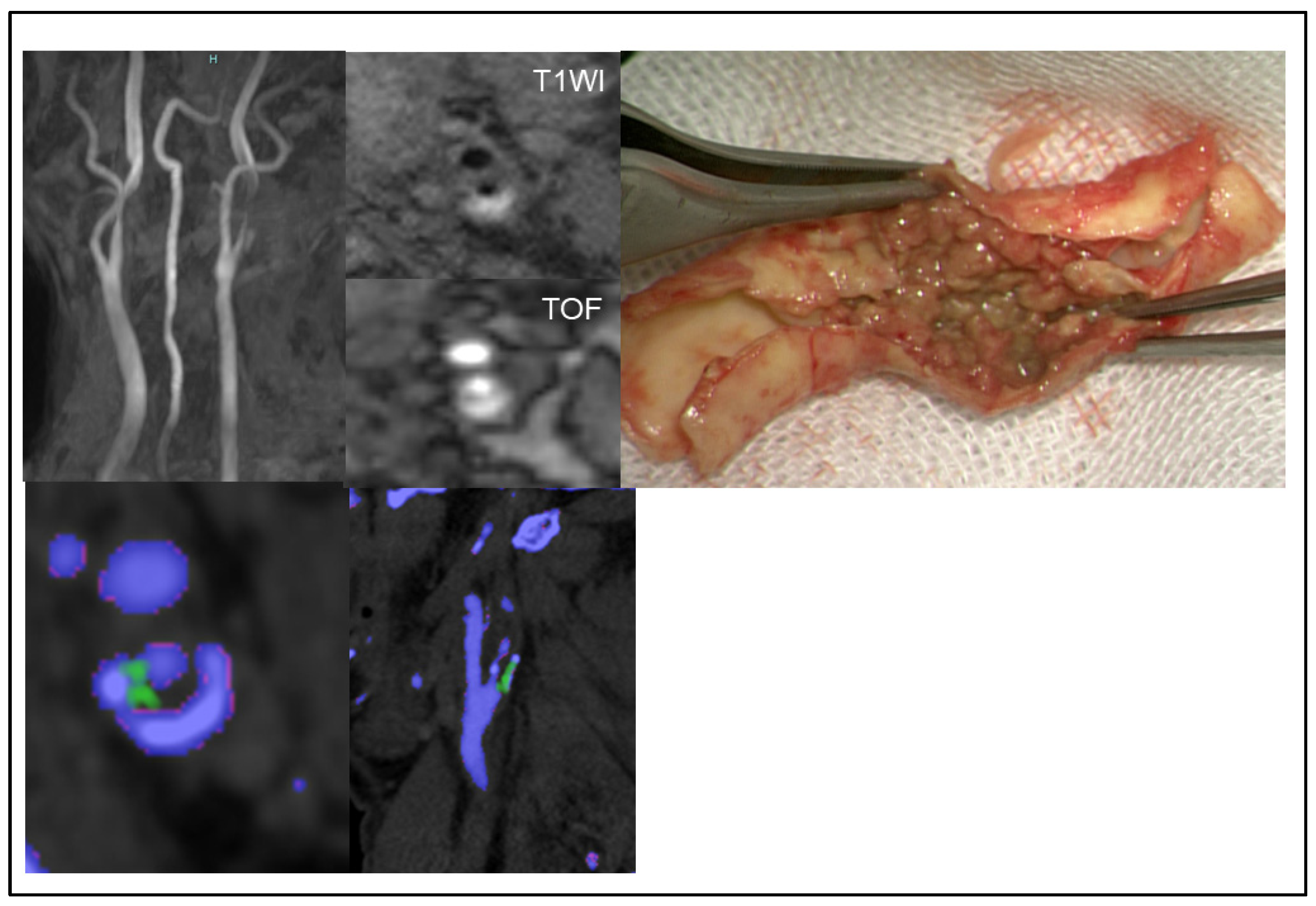 Jcm 14 00518 g004 Jcm 14 00518 g004