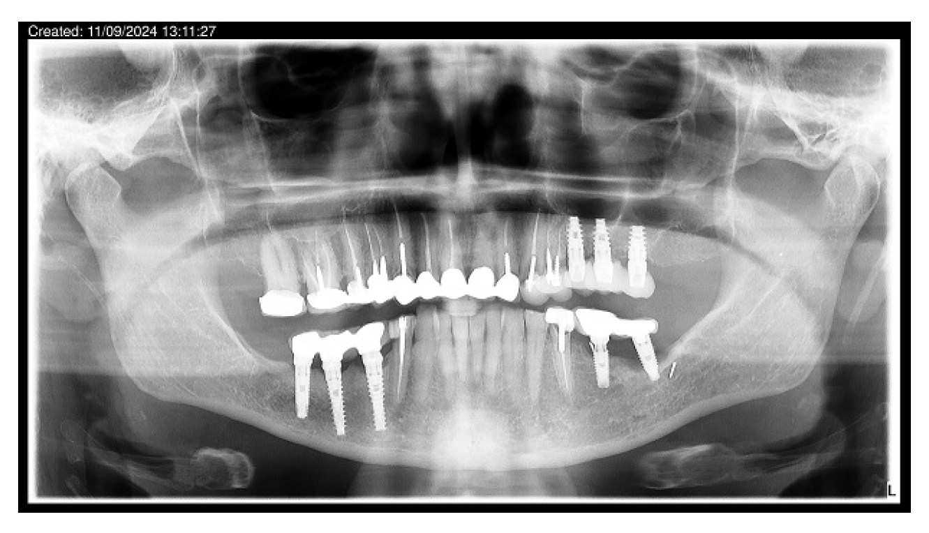 Jcm 14 02246 g010 Jcm 14 02246 g010