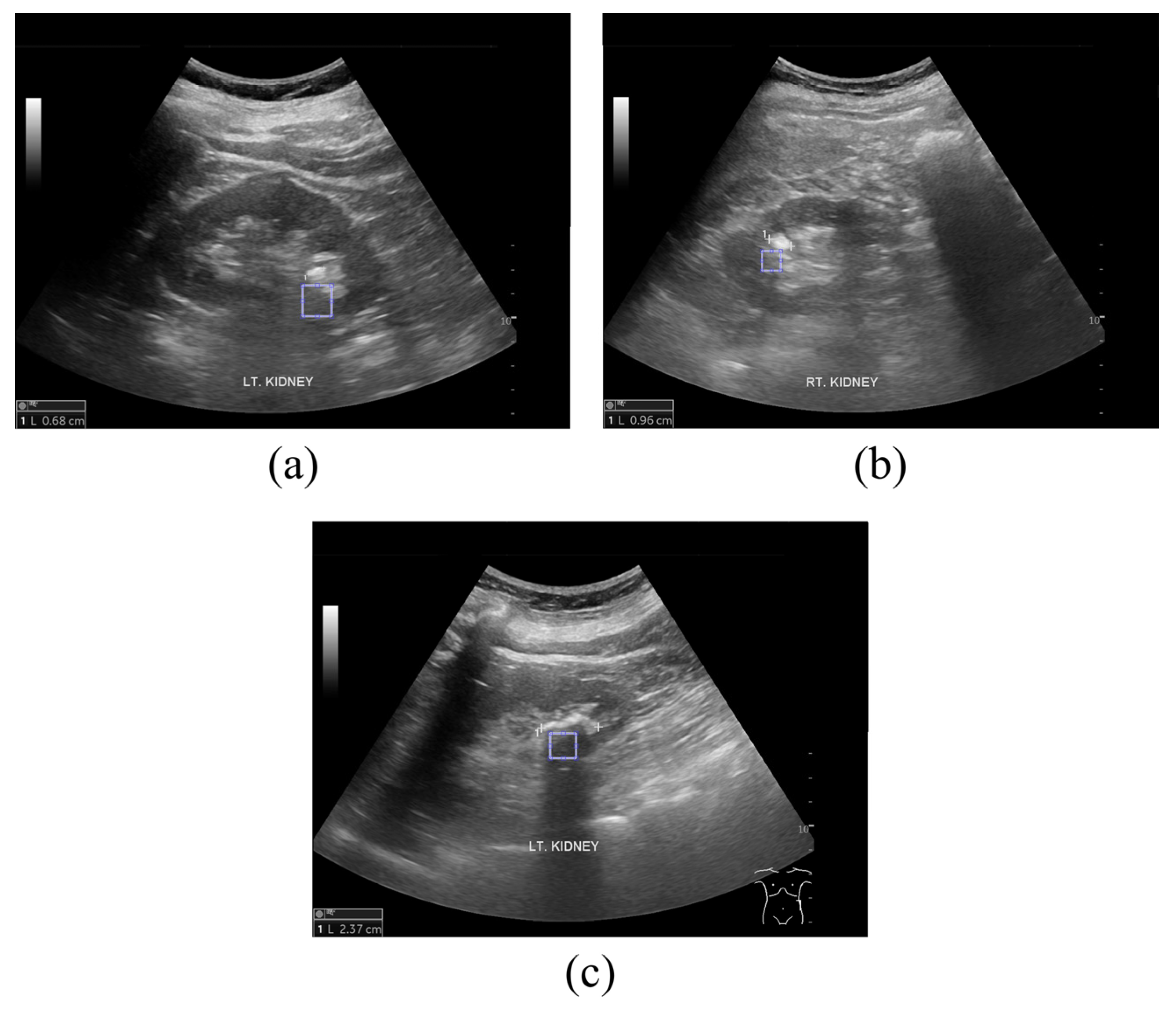 Jcm 14 02268 g002 Jcm 14 02268 g002