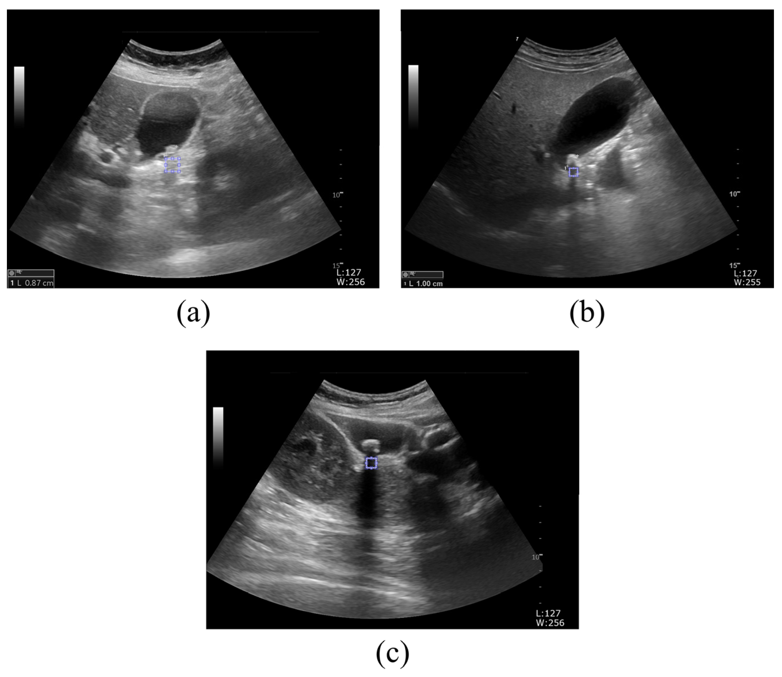 Jcm 14 02268 g004 Jcm 14 02268 g004