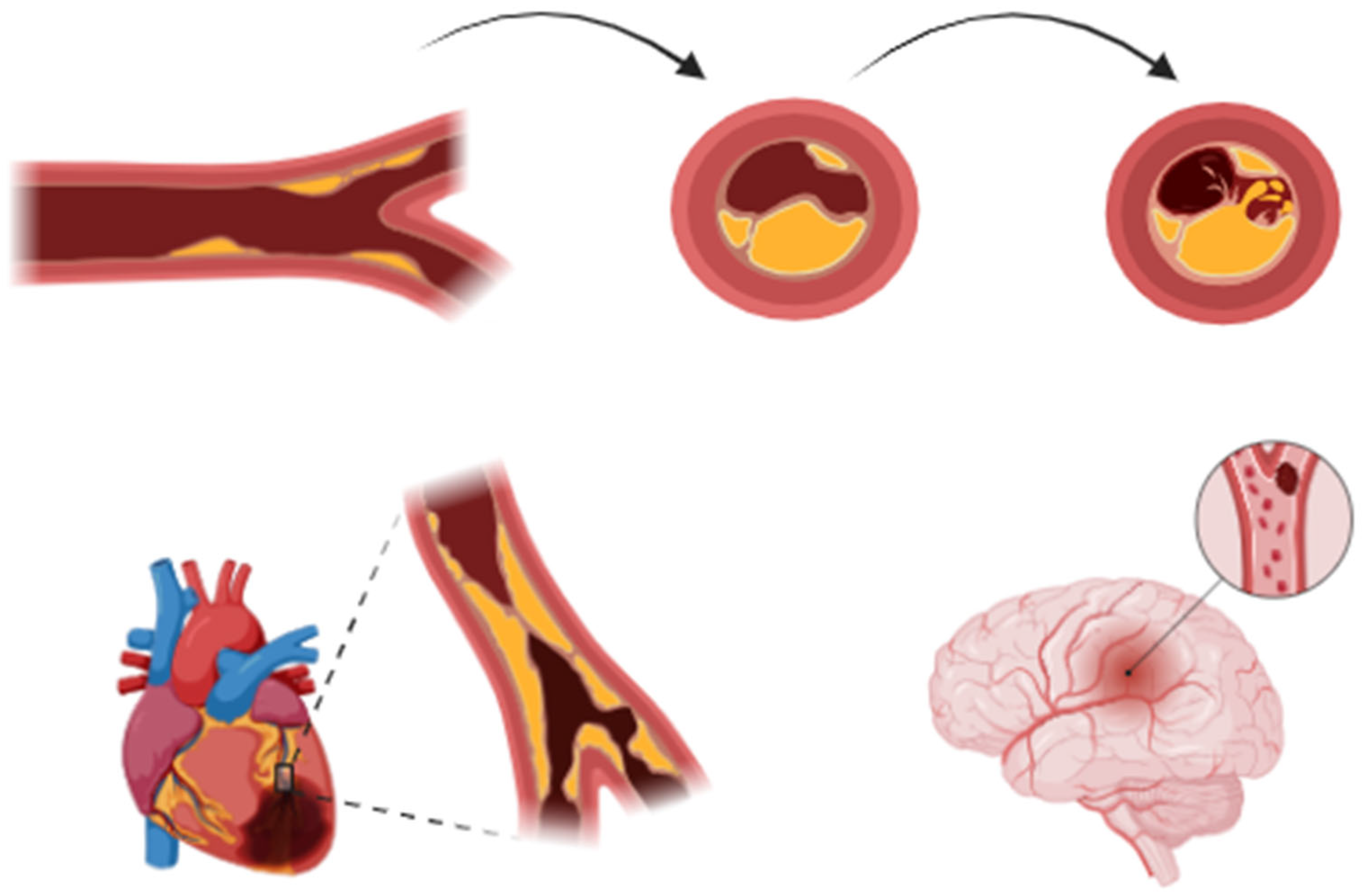Jcm 14 02354 g001 Jcm 14 02354 g001