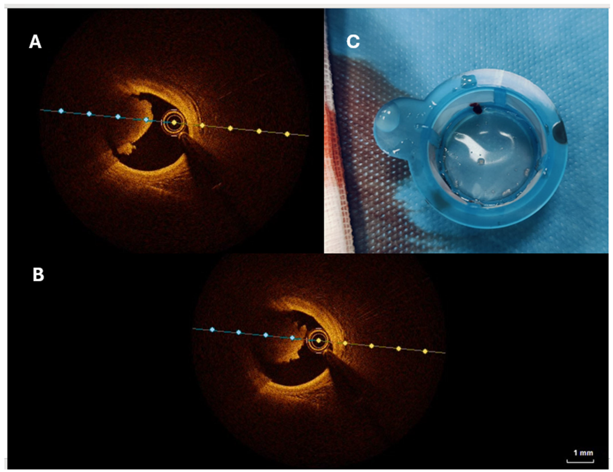 Jcm 14 02354 g002 Jcm 14 02354 g002