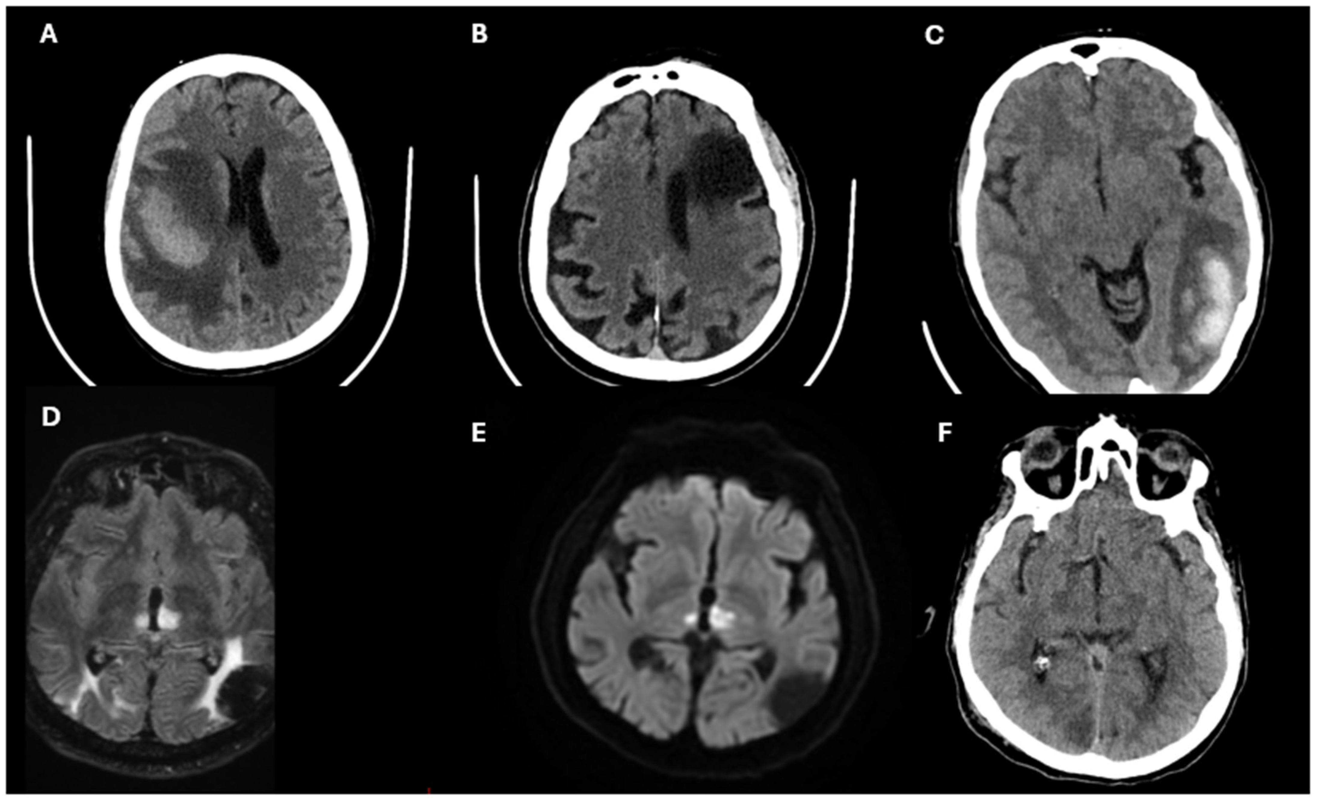Jcm 14 02354 g003 Jcm 14 02354 g003