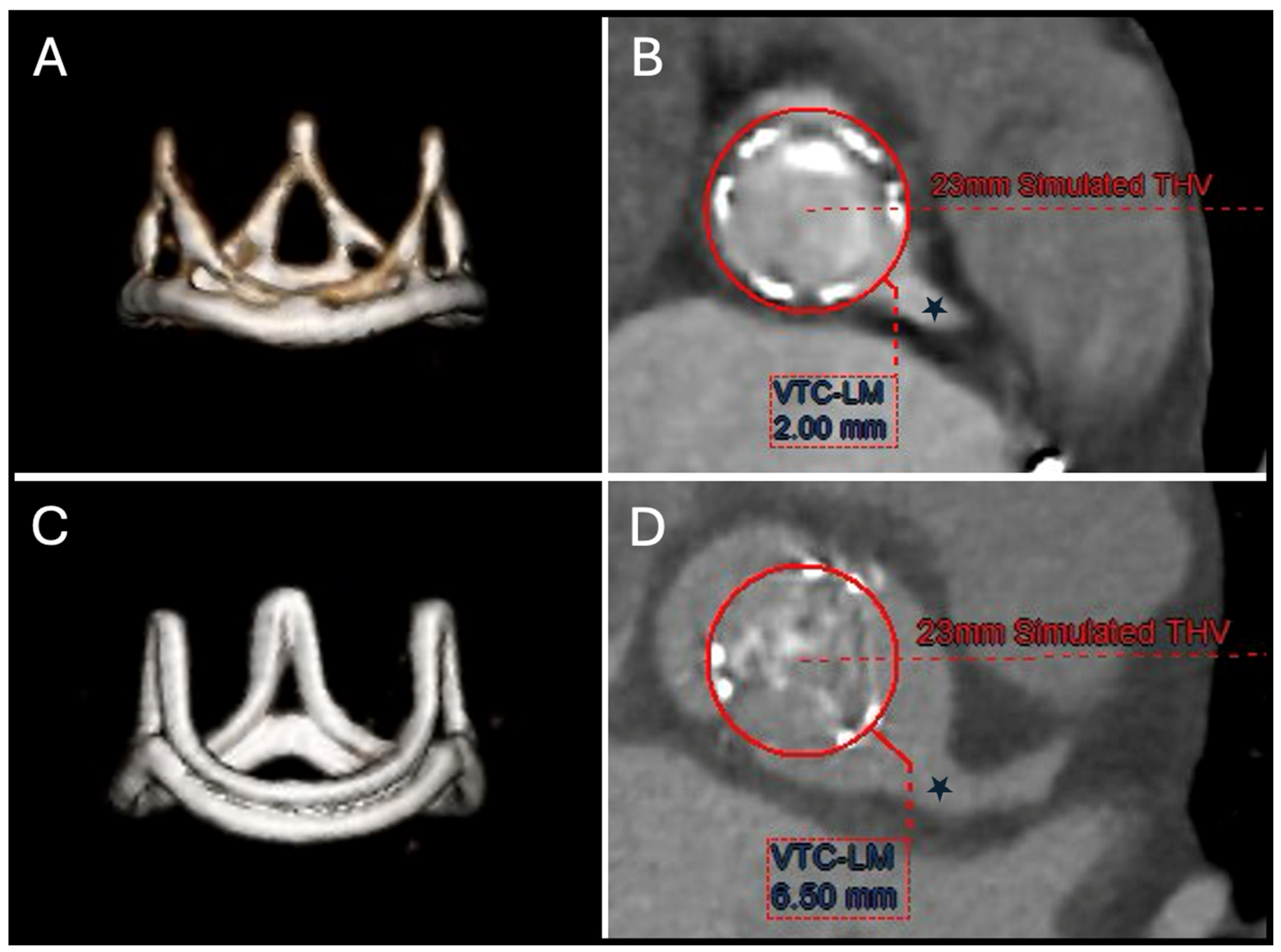 Jcm 14 02474 g002 Jcm 14 02474 g002