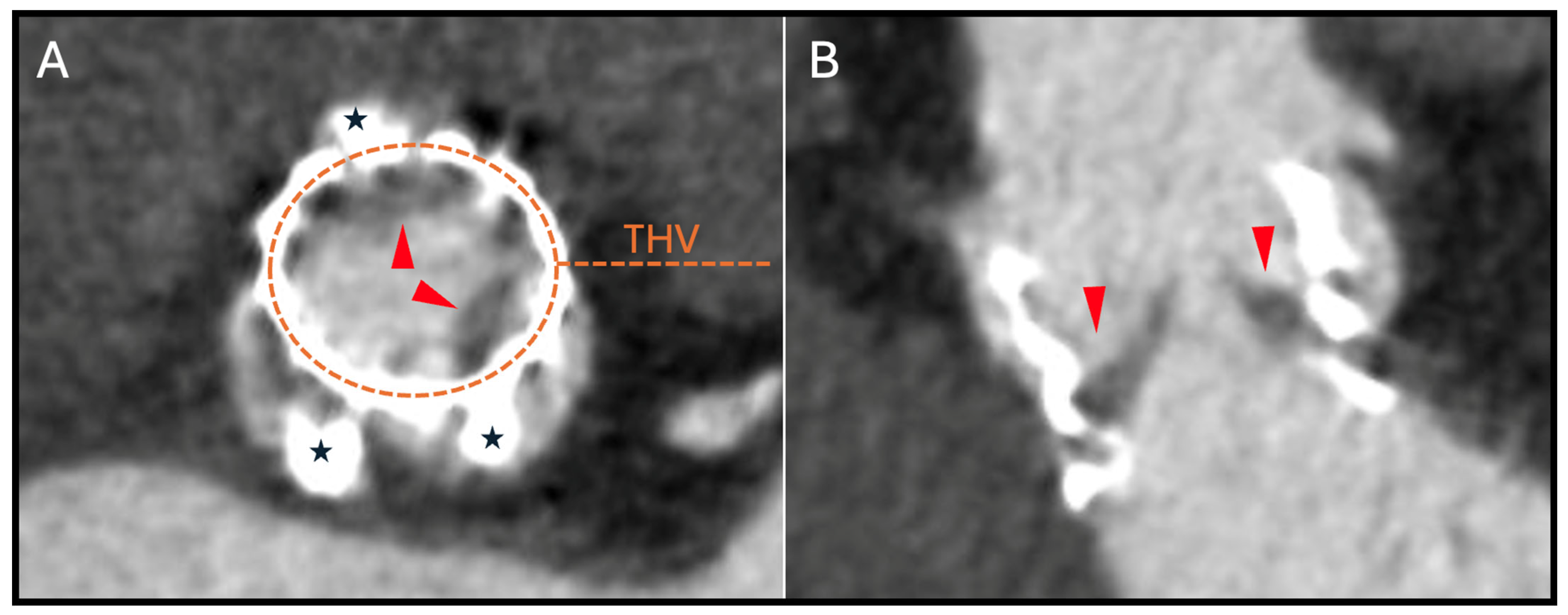 Jcm 14 02474 g003 Jcm 14 02474 g003