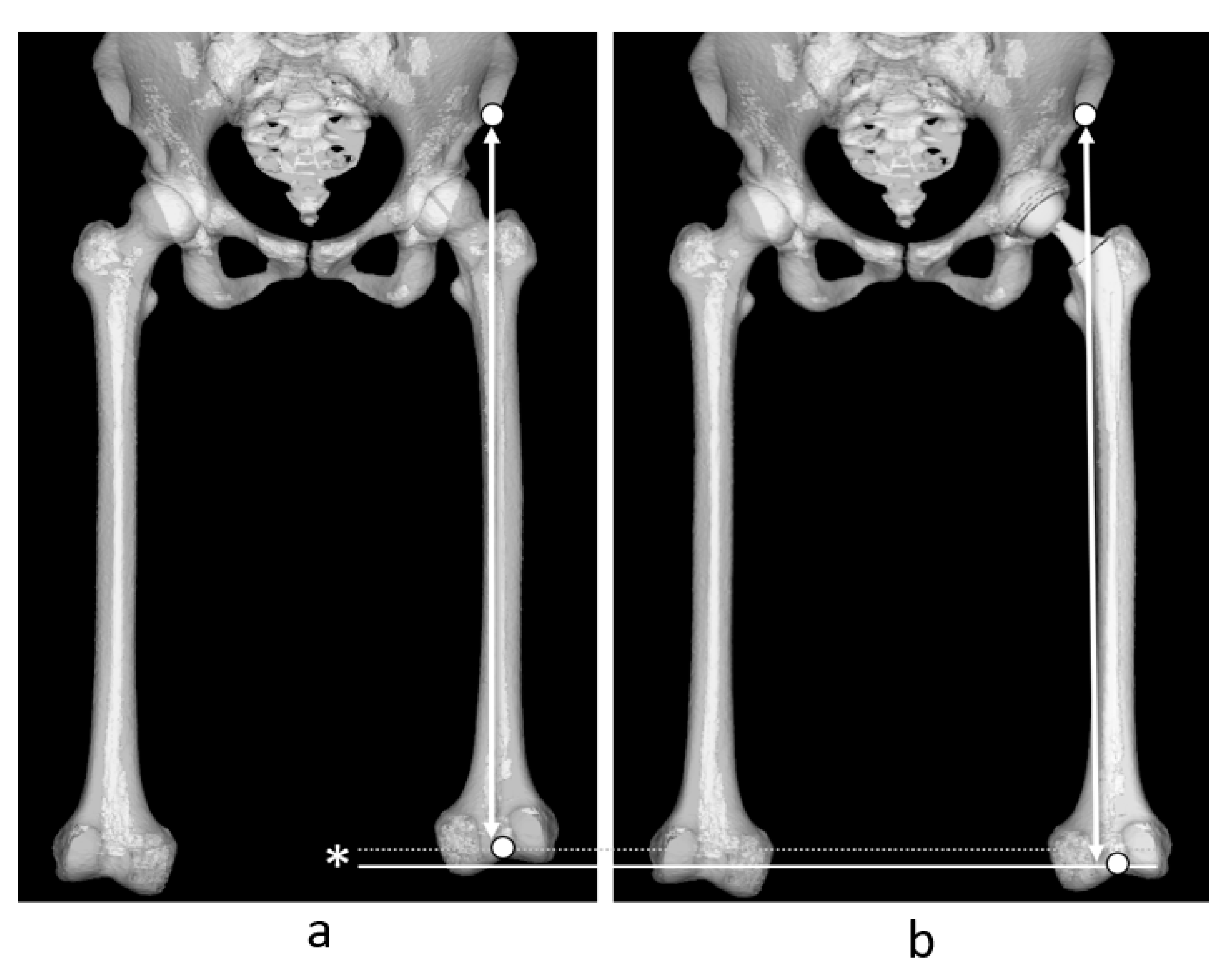 Jcm 14 02893 g005 Jcm 14 02893 g005