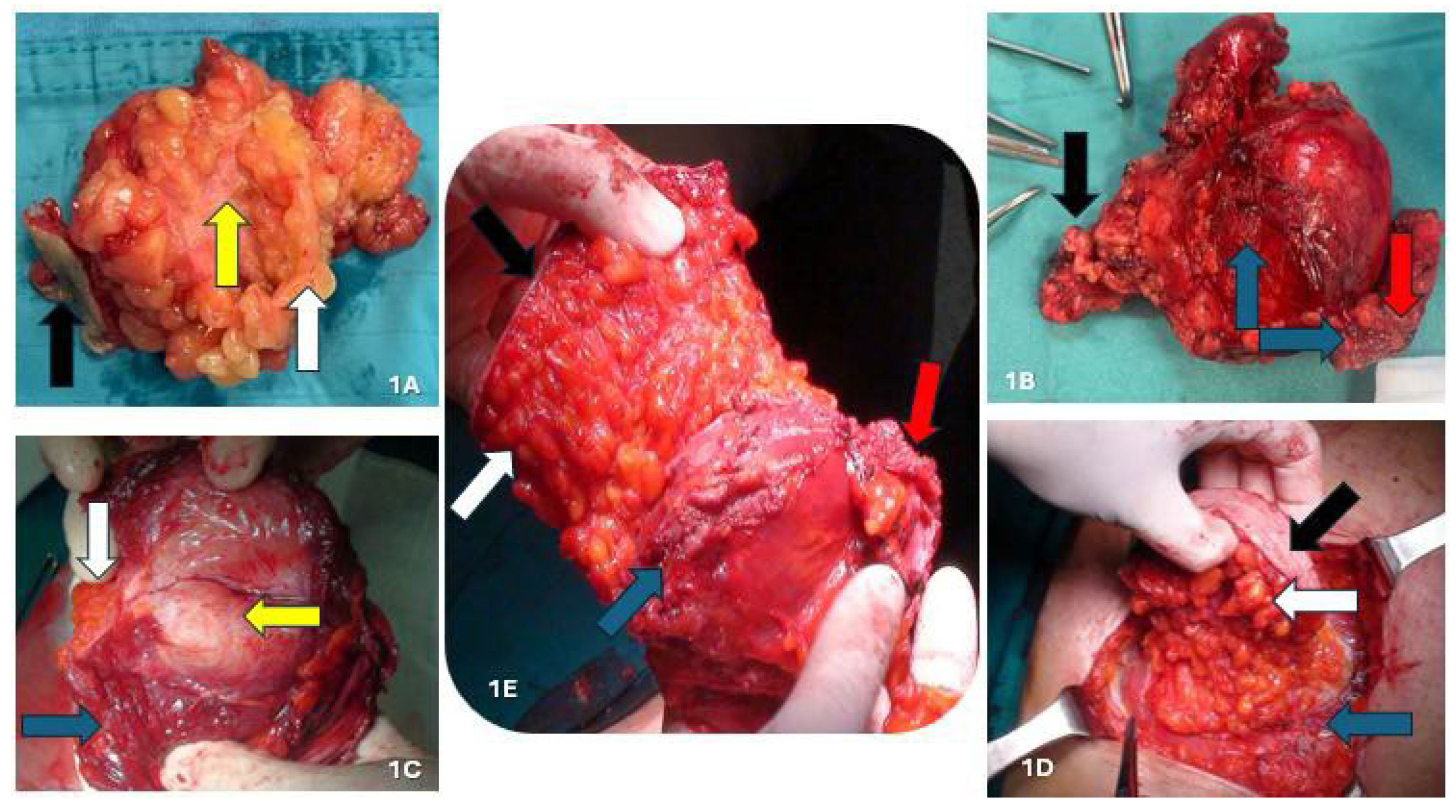 Jcm 14 05416 g001 Jcm 14 05416 g001