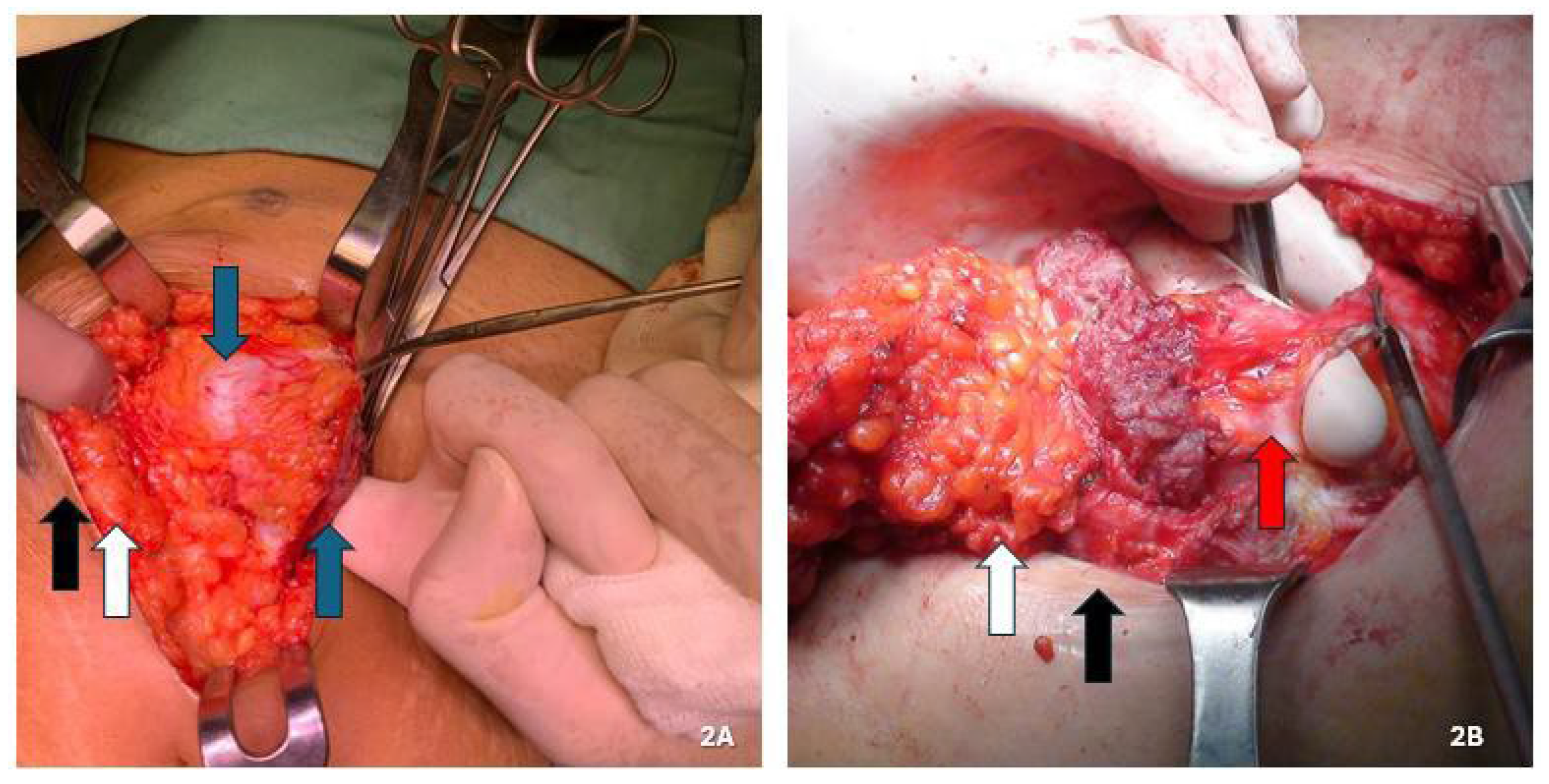 Jcm 14 05416 g002 Jcm 14 05416 g002