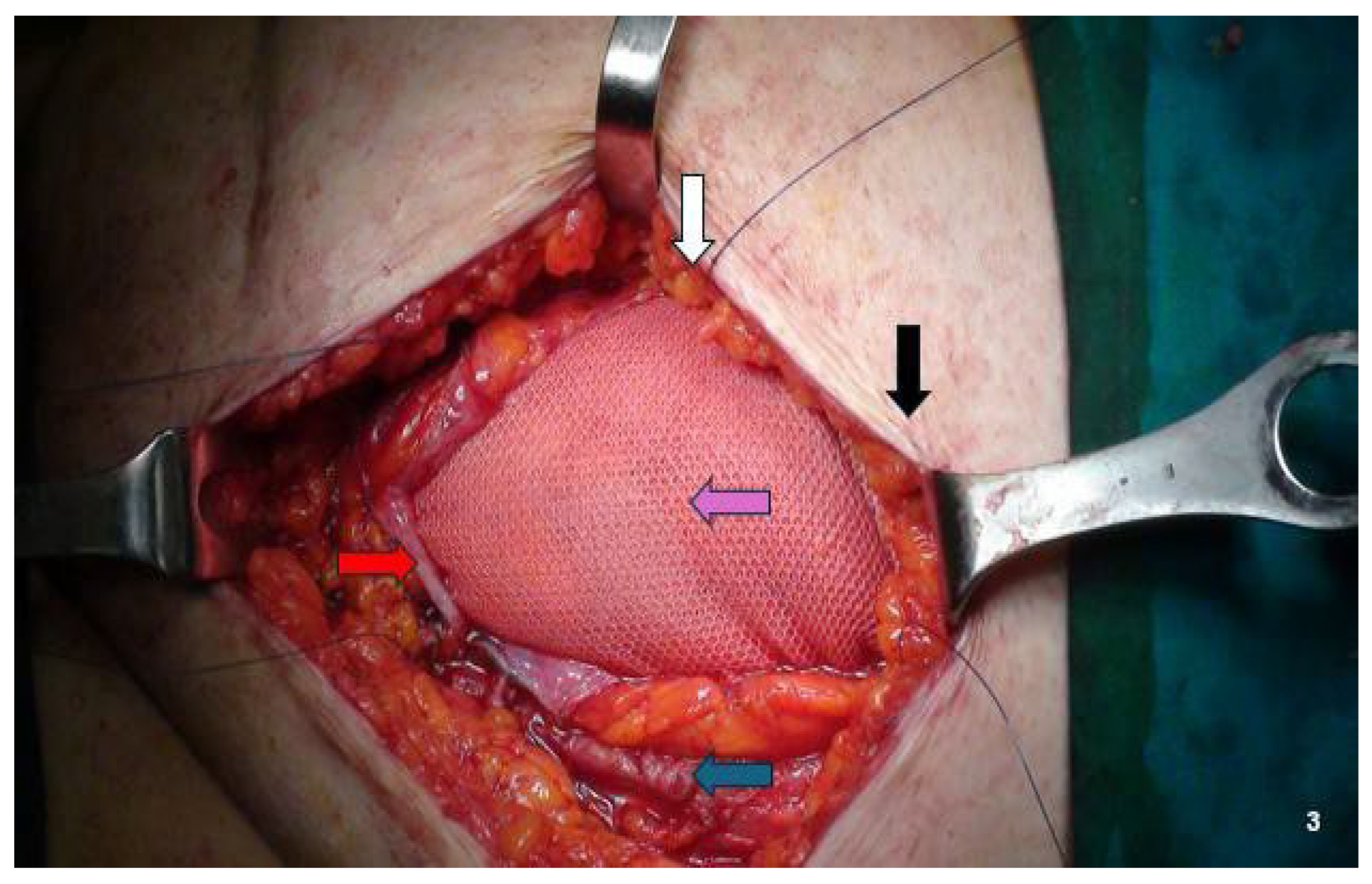 Jcm 14 05416 g003 Jcm 14 05416 g003