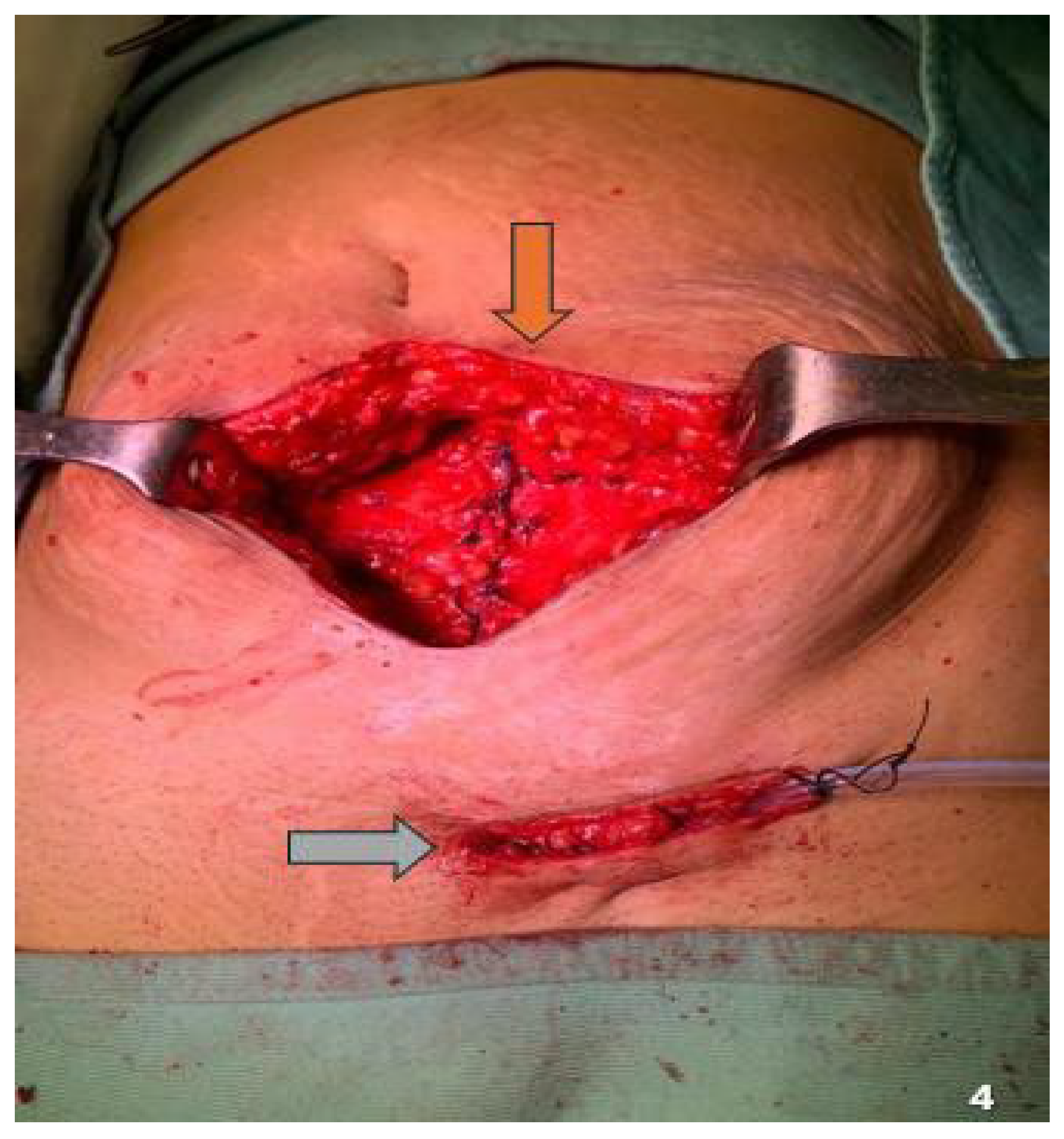 Jcm 14 05416 g004 Jcm 14 05416 g004