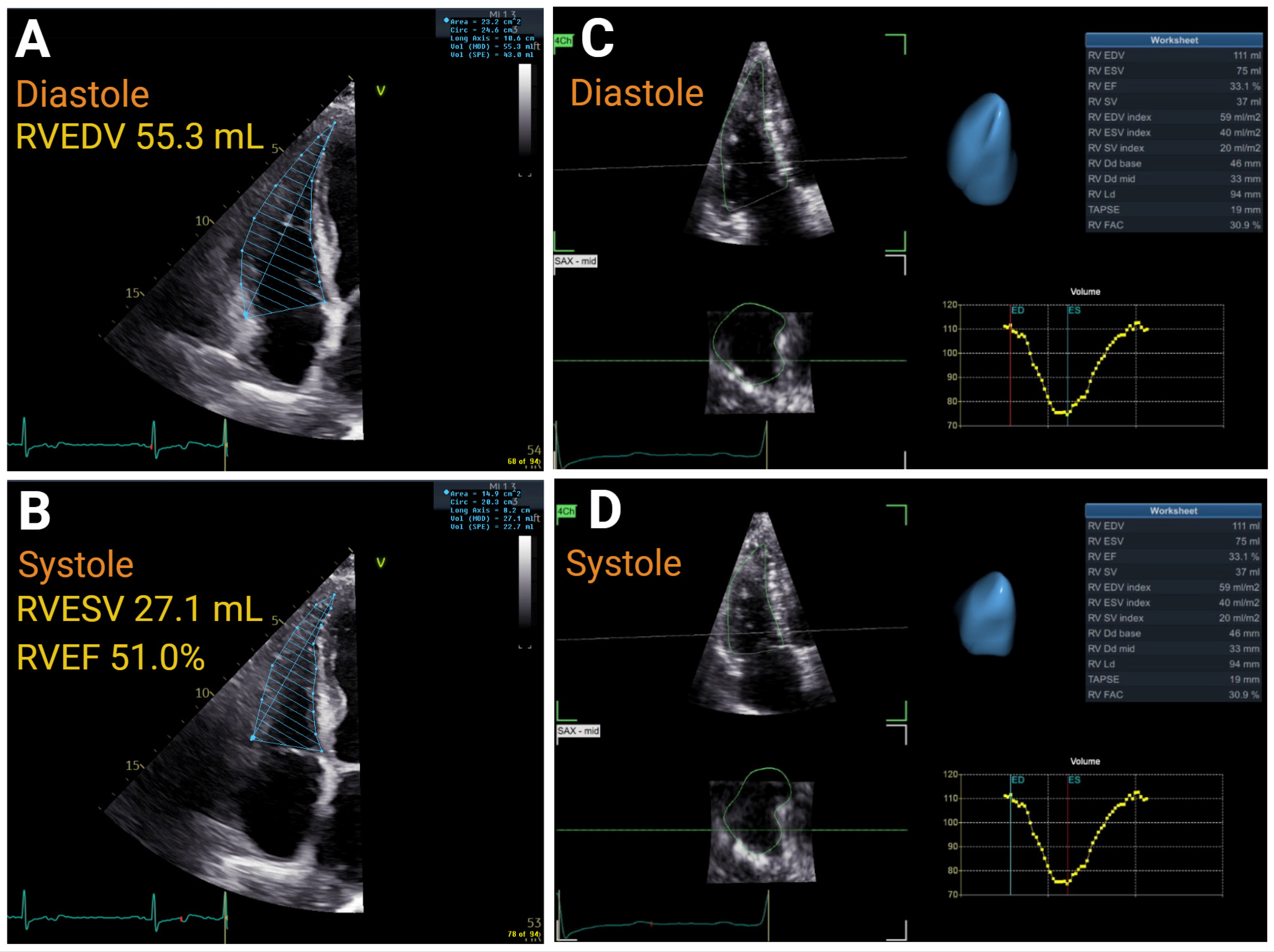 Jcm 14 05505 g002 Jcm 14 05505 g002
