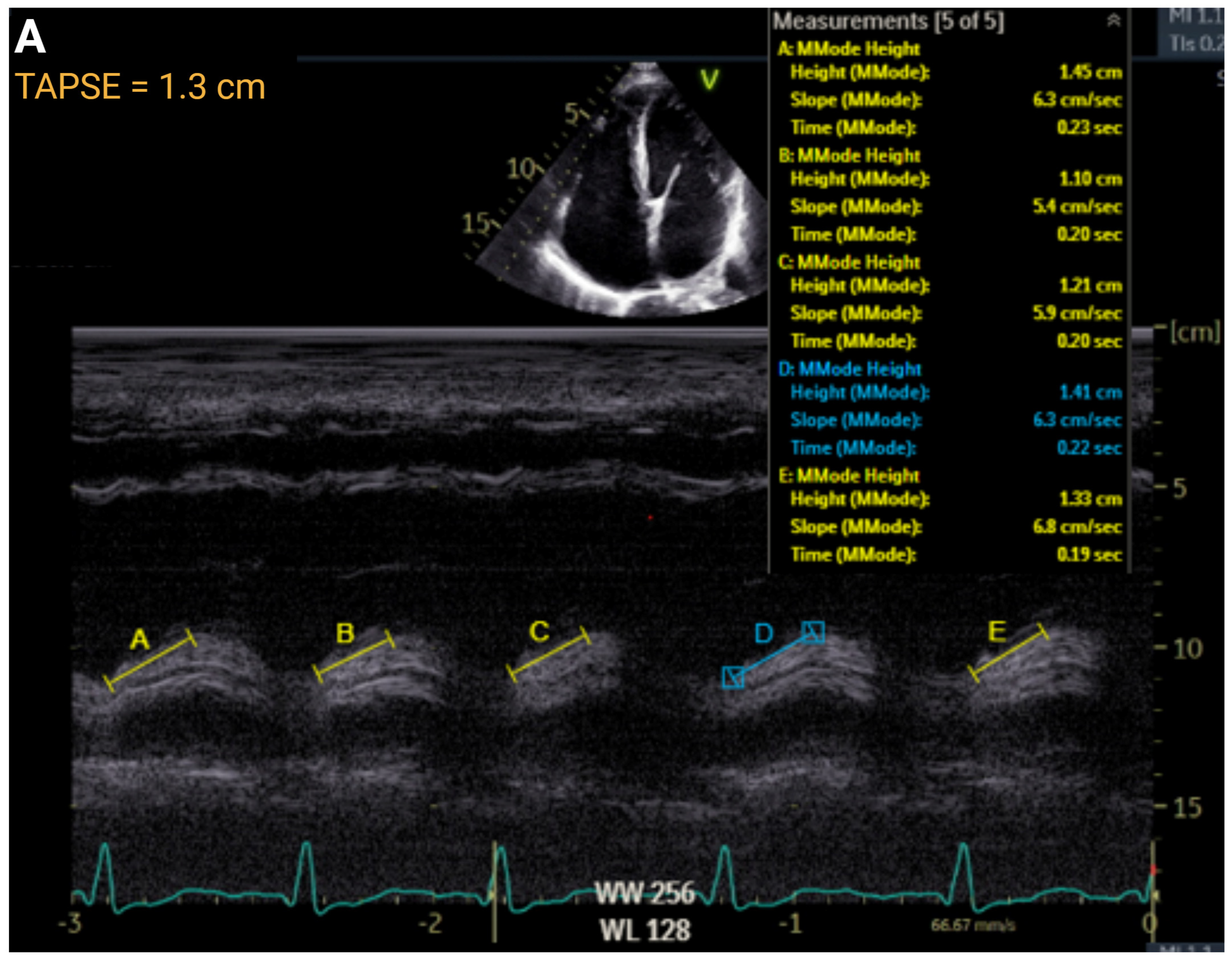 Jcm 14 05505 g003a Jcm 14 05505 g003a