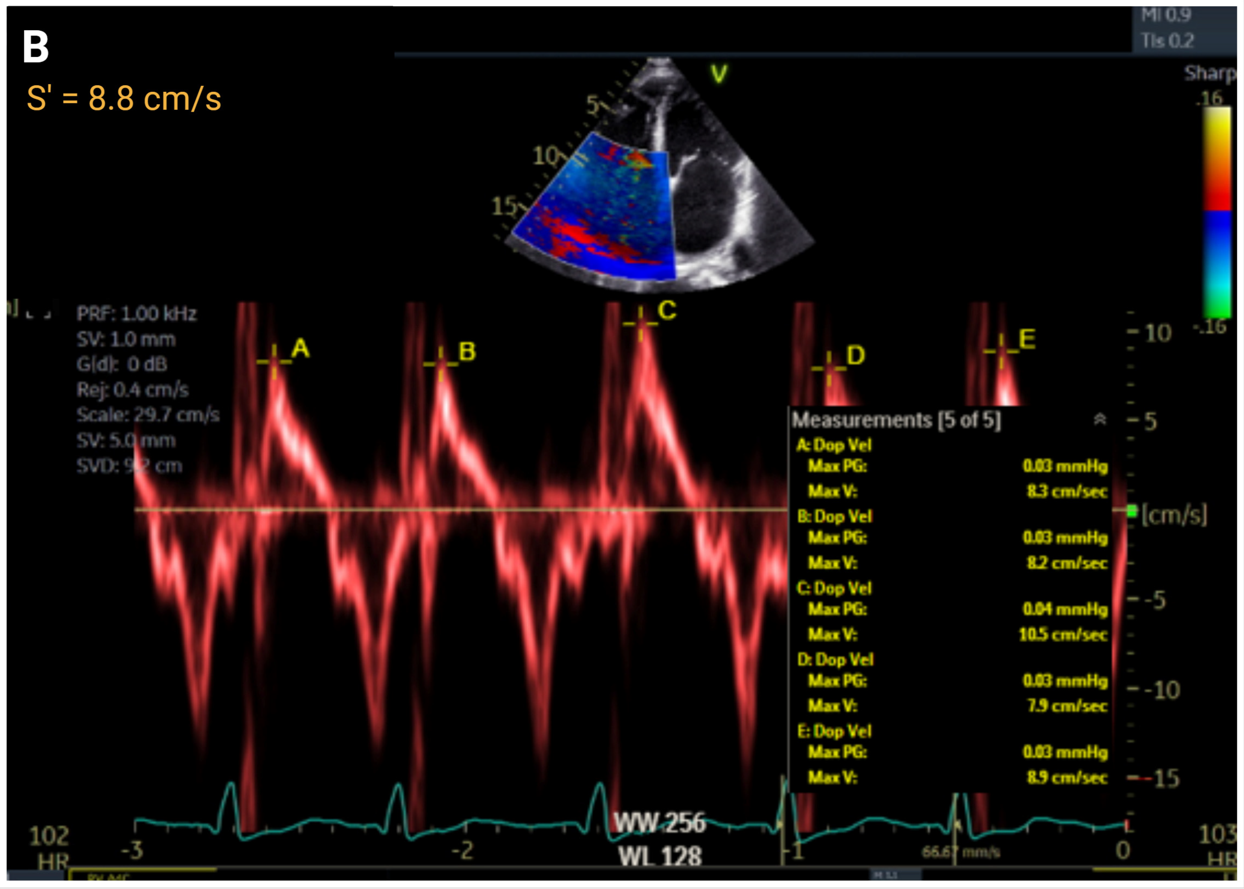 Jcm 14 05505 g003b Jcm 14 05505 g003b
