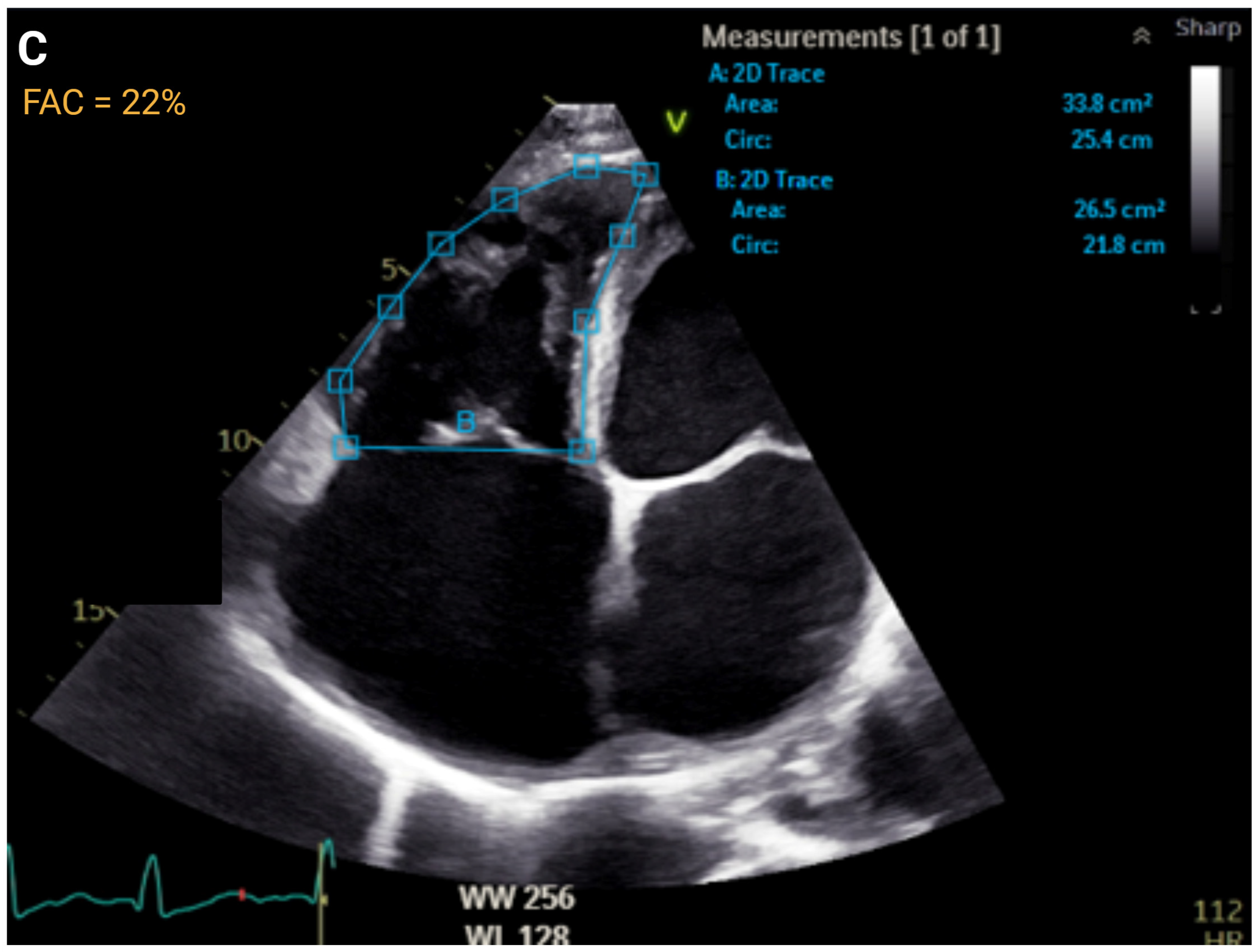 Jcm 14 05505 g003c Jcm 14 05505 g003c