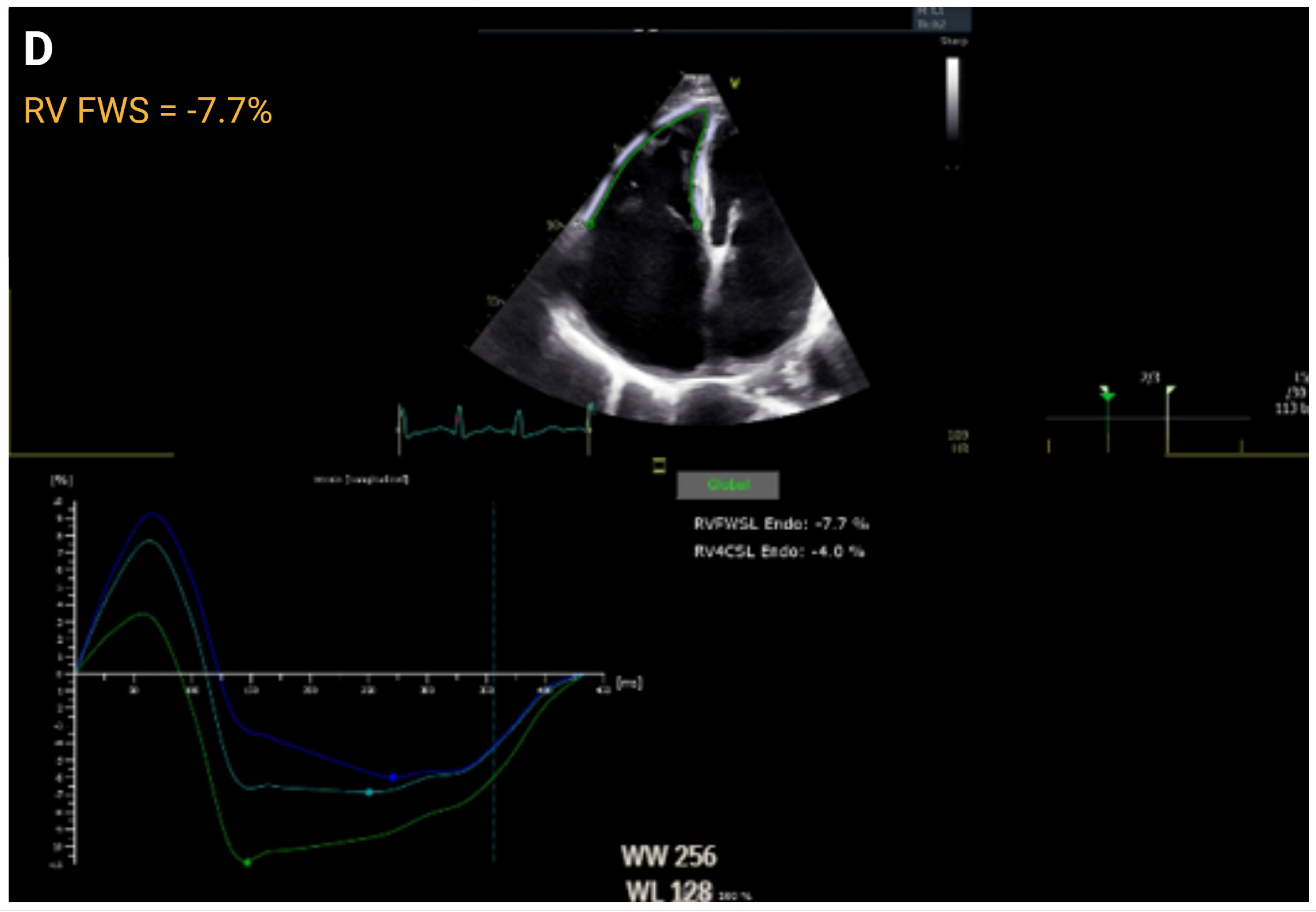 Jcm 14 05505 g003d Jcm 14 05505 g003d