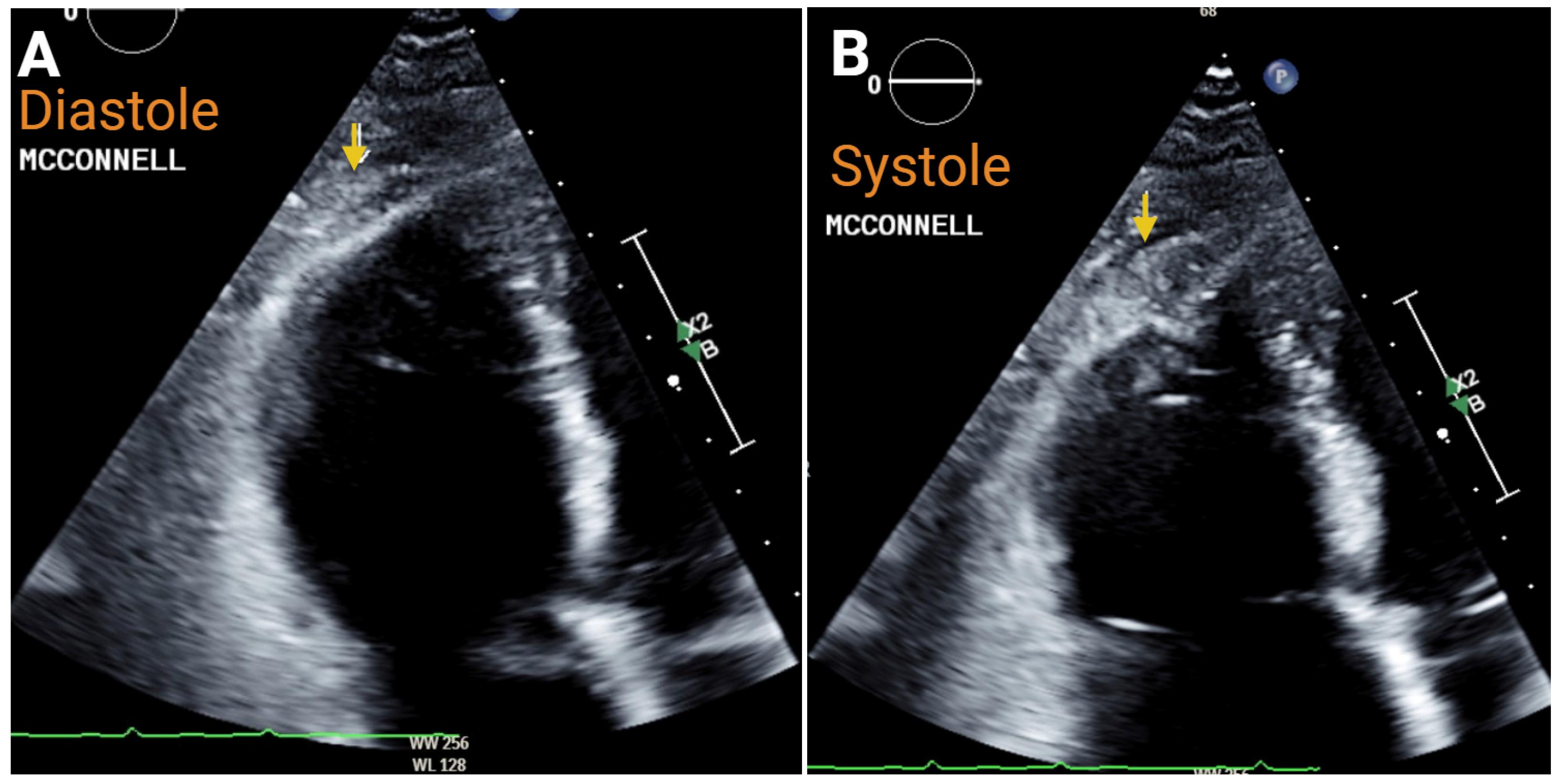 Jcm 14 05505 g005 Jcm 14 05505 g005
