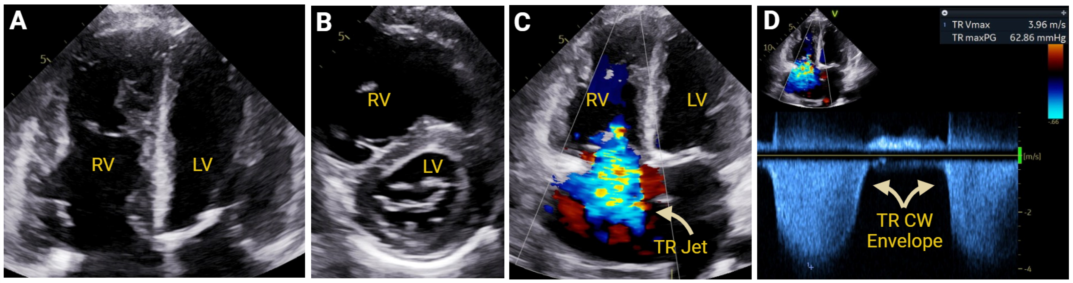 Jcm 14 05505 g008 Jcm 14 05505 g008