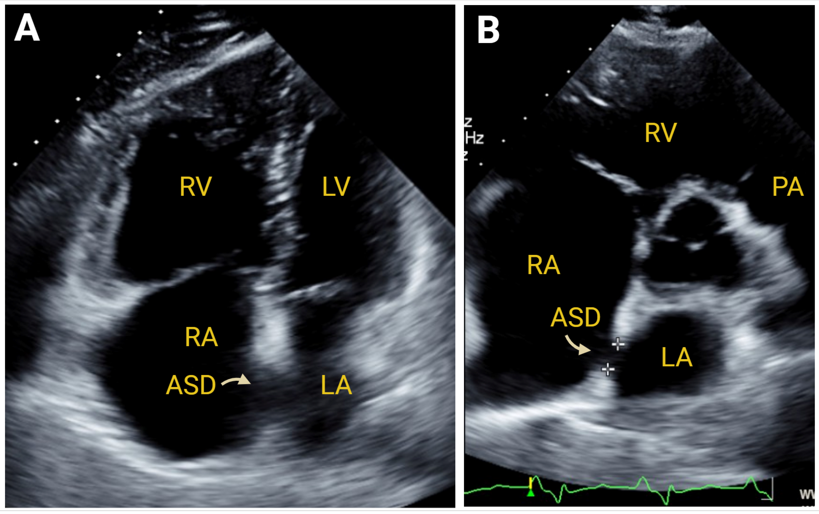 Jcm 14 05505 g009 Jcm 14 05505 g009