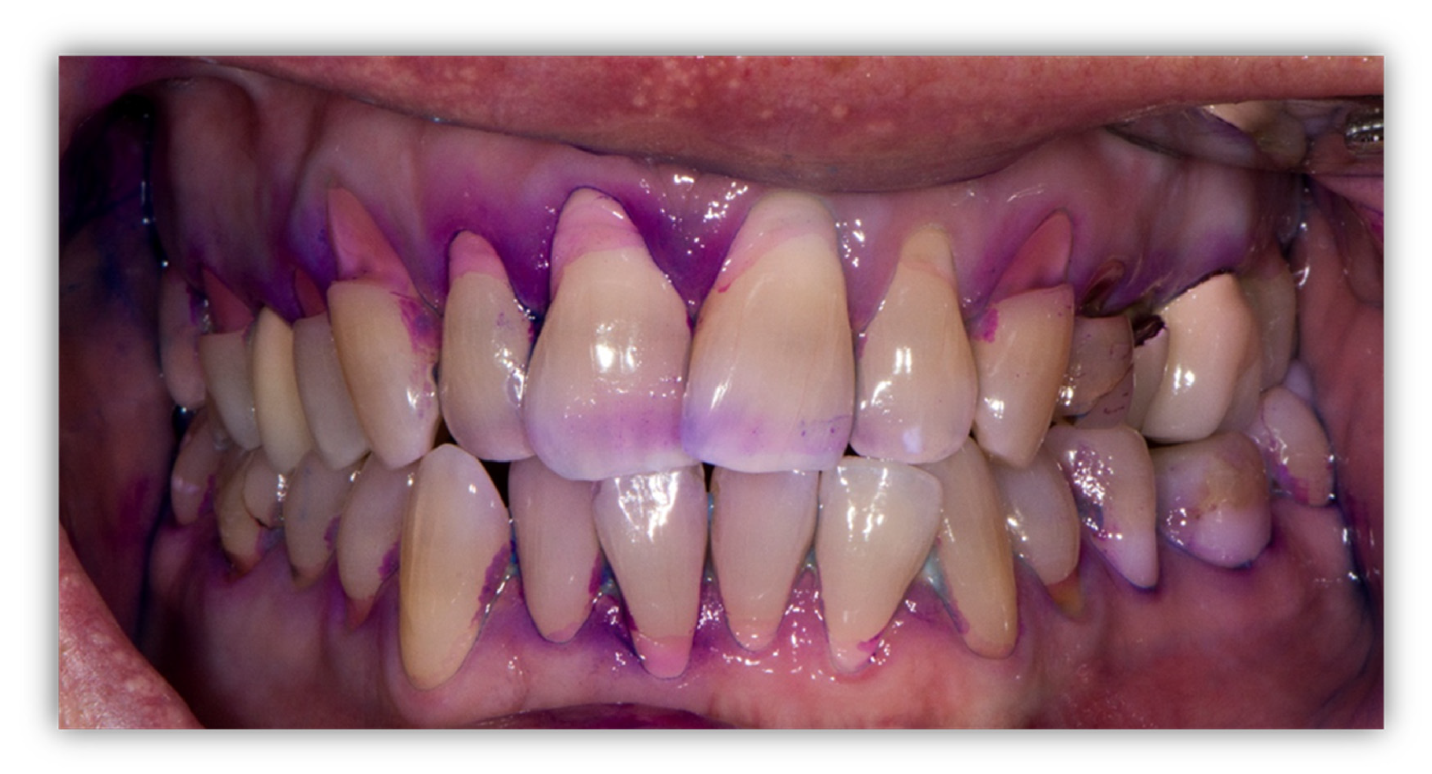 Jcm 14 05576 g001 Jcm 14 05576 g001