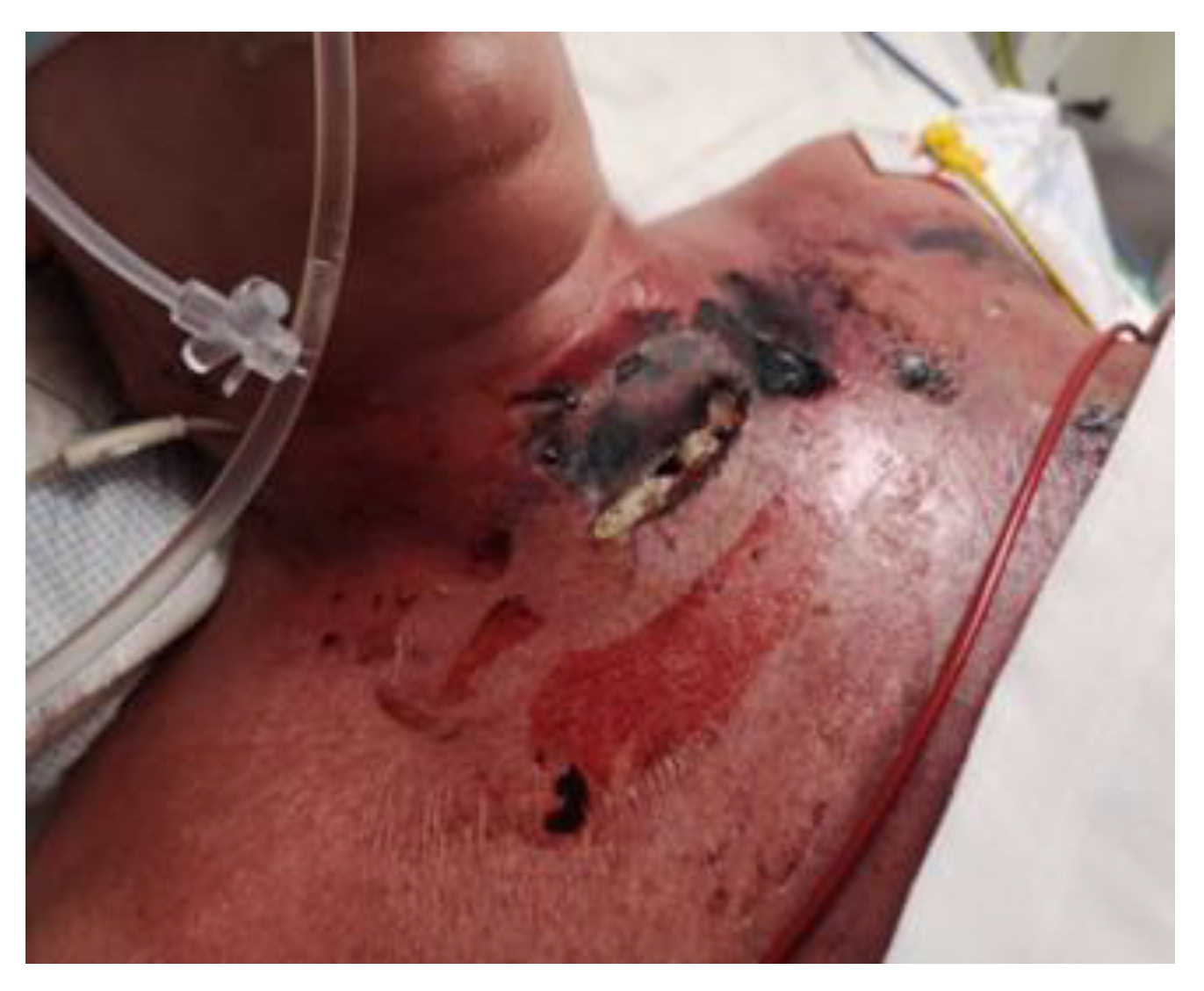 Jcm 14 05634 g001 Jcm 14 05634 g001