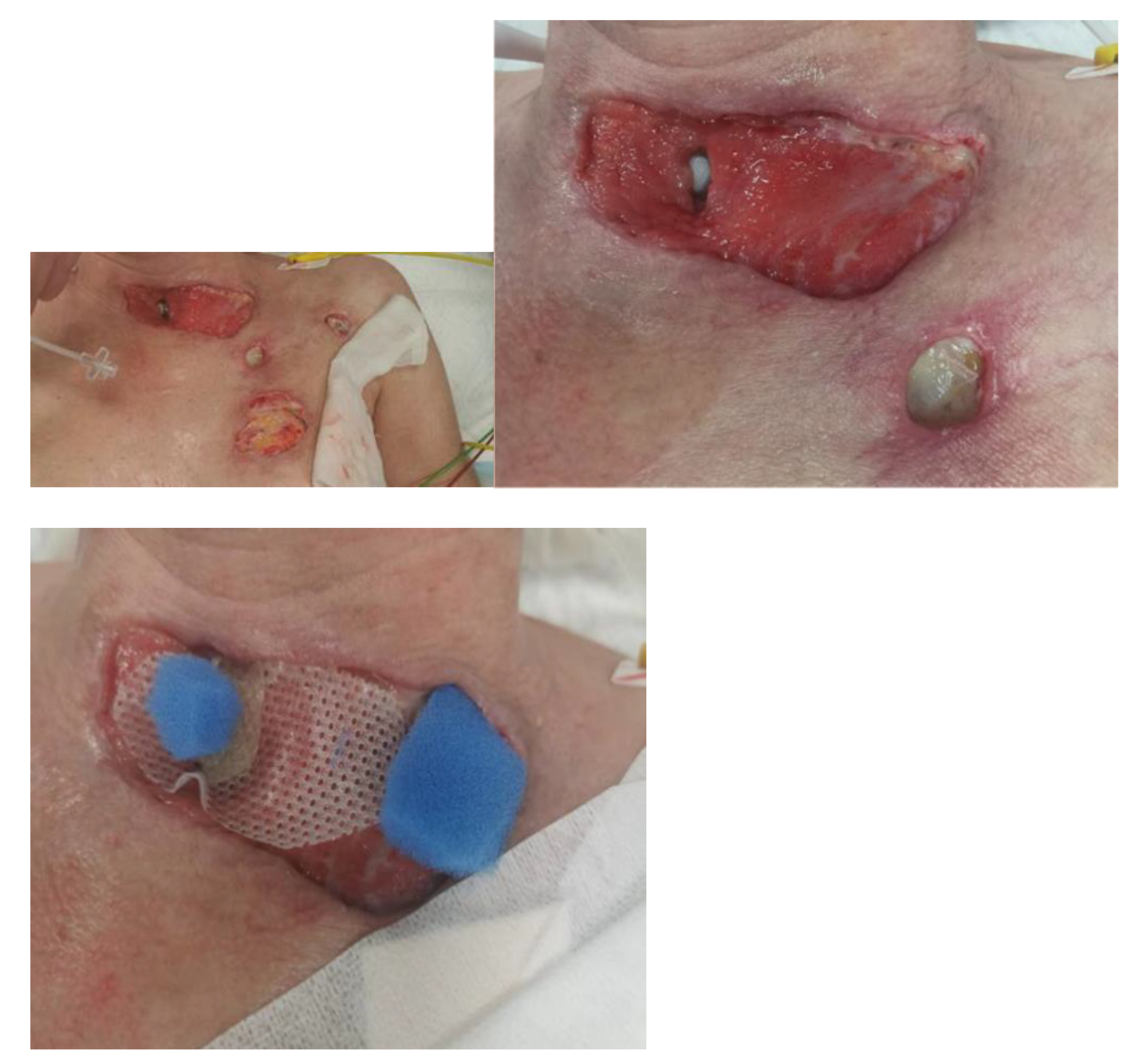 Jcm 14 05634 g006b Jcm 14 05634 g006b