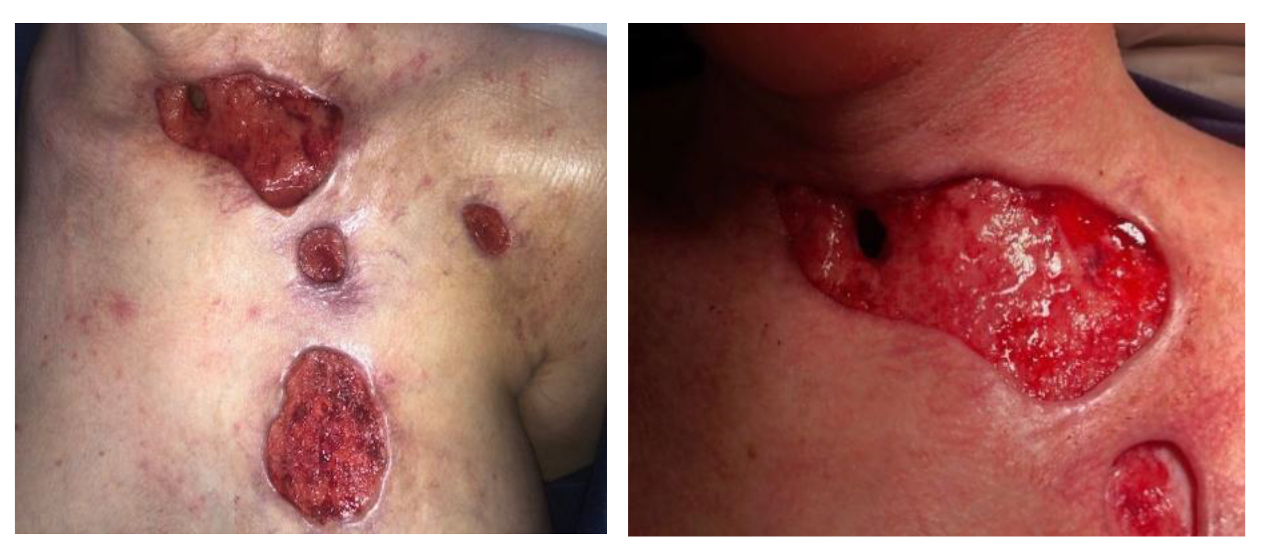 Jcm 14 05634 g007b Jcm 14 05634 g007b