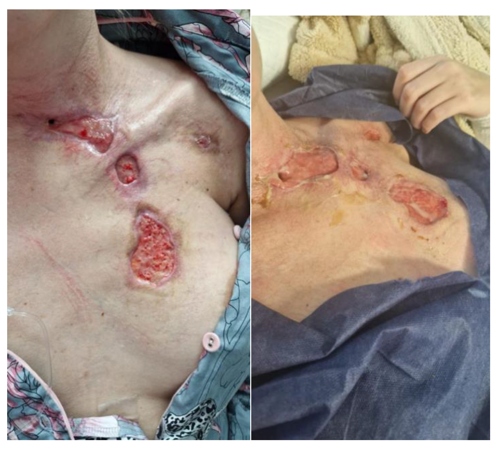 Jcm 14 05634 g008 Jcm 14 05634 g008