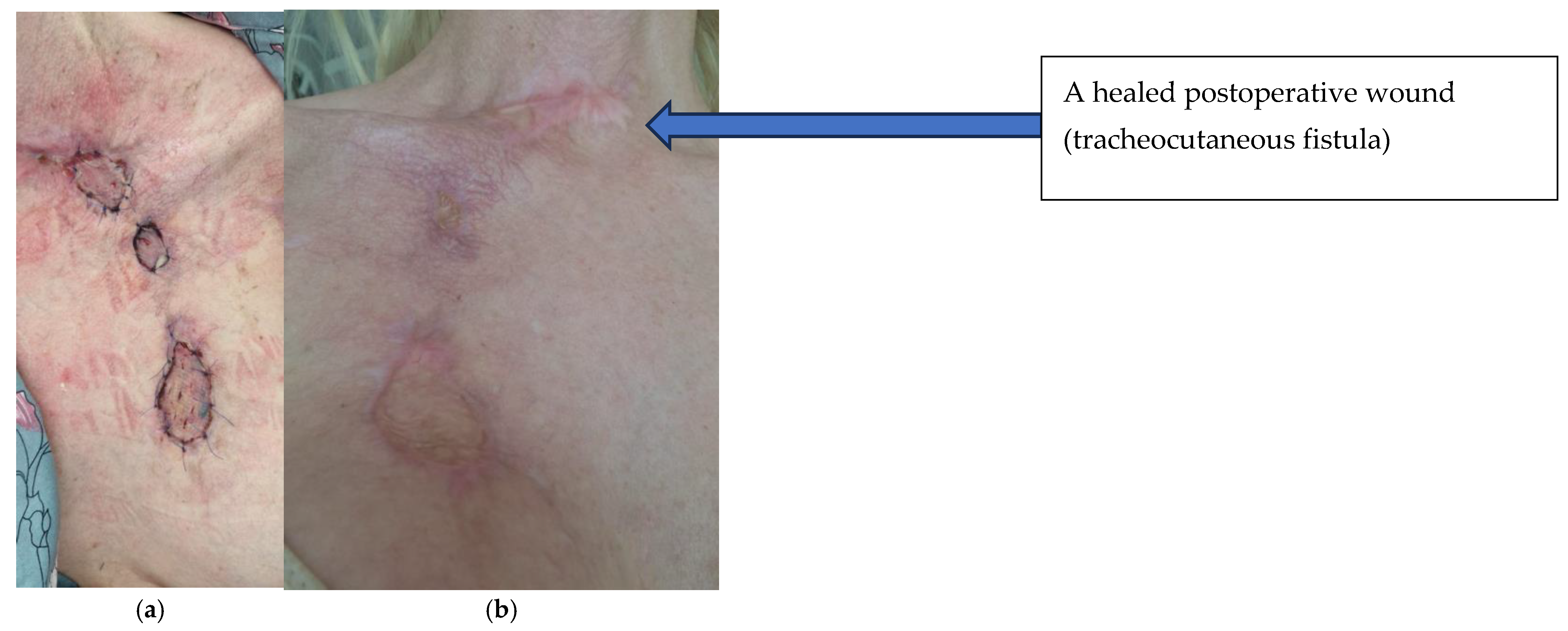 Jcm 14 05634 g009 Jcm 14 05634 g009
