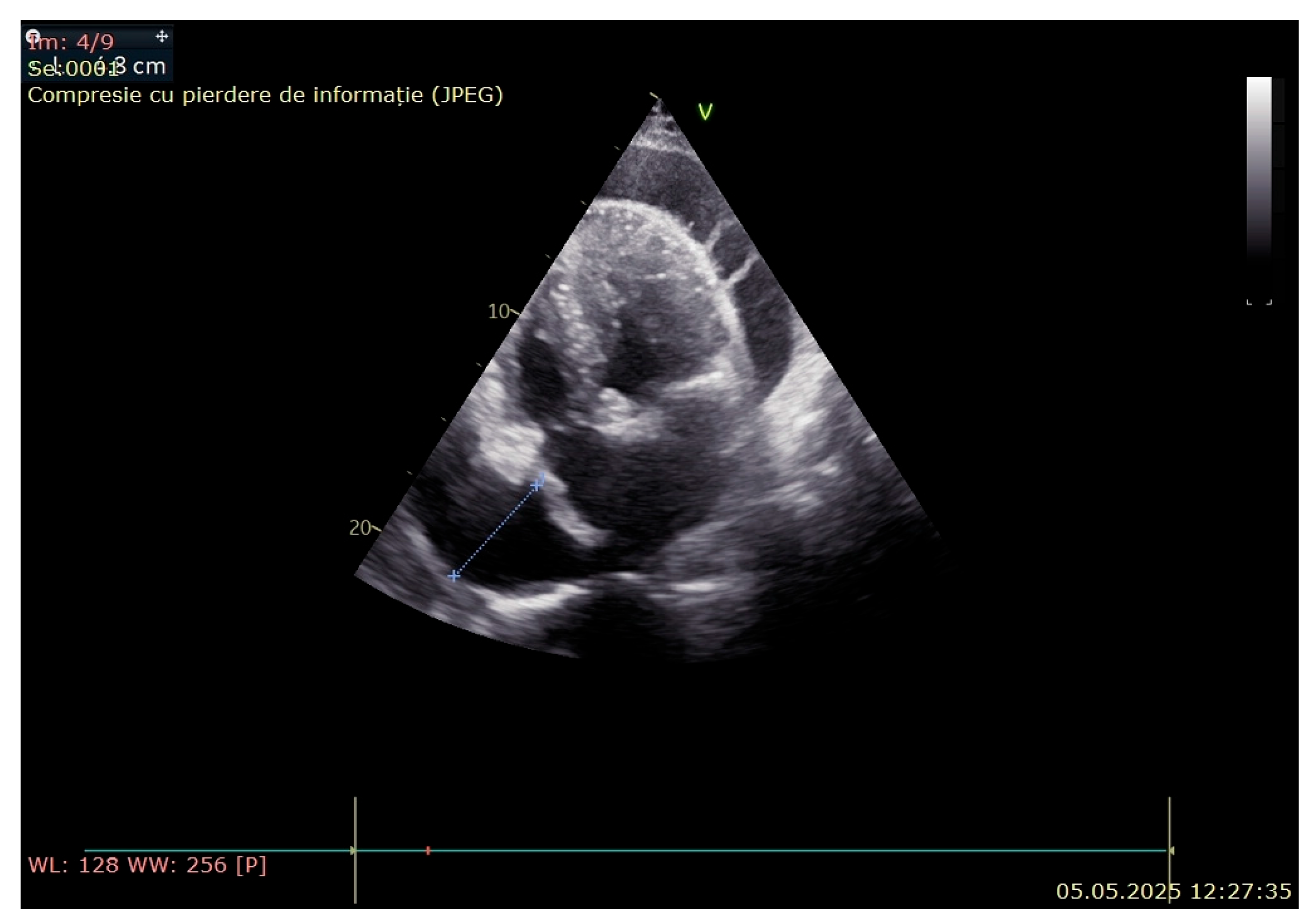Jcm 14 05944 g004 Jcm 14 05944 g004