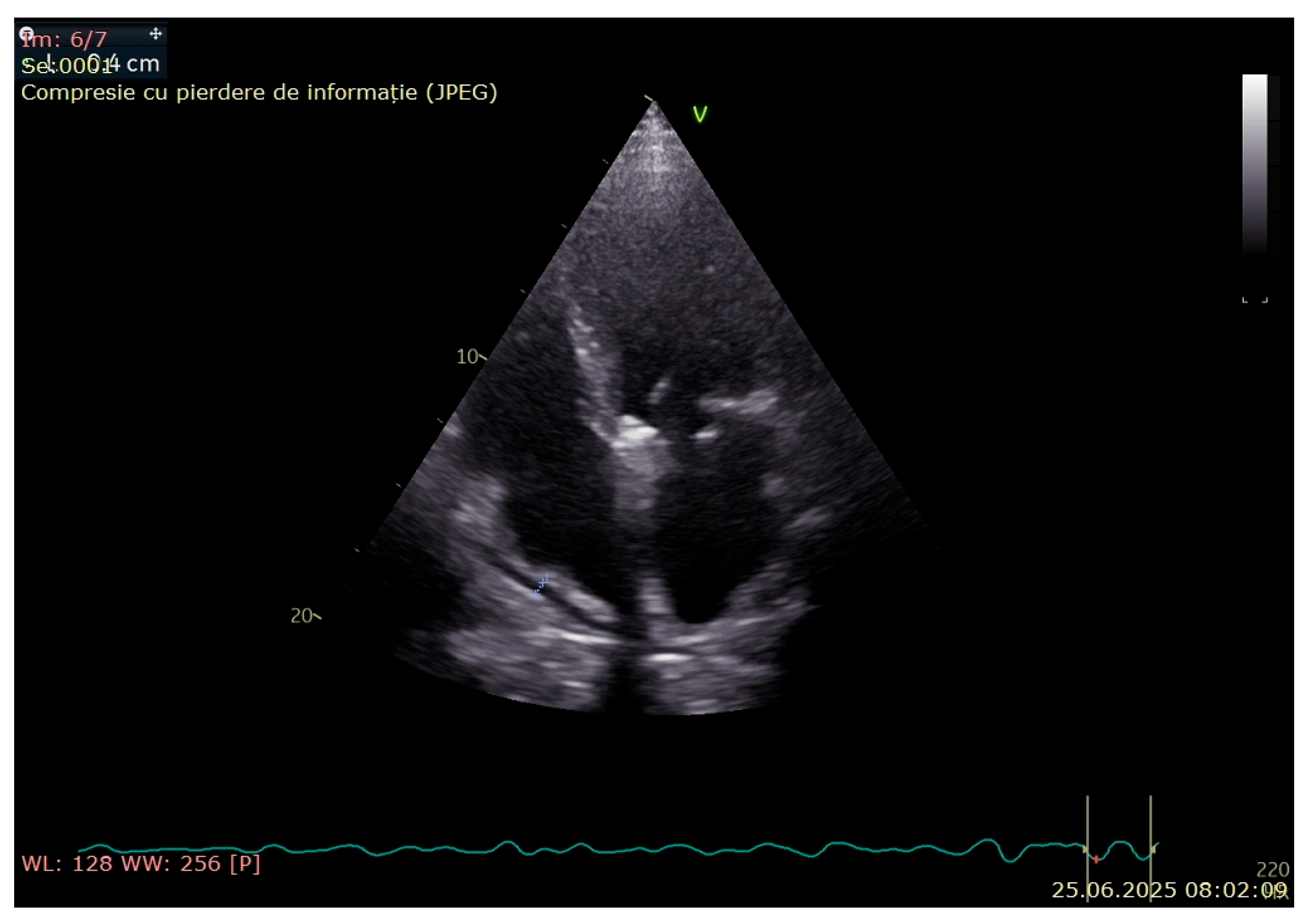 Jcm 14 05944 g006 Jcm 14 05944 g006