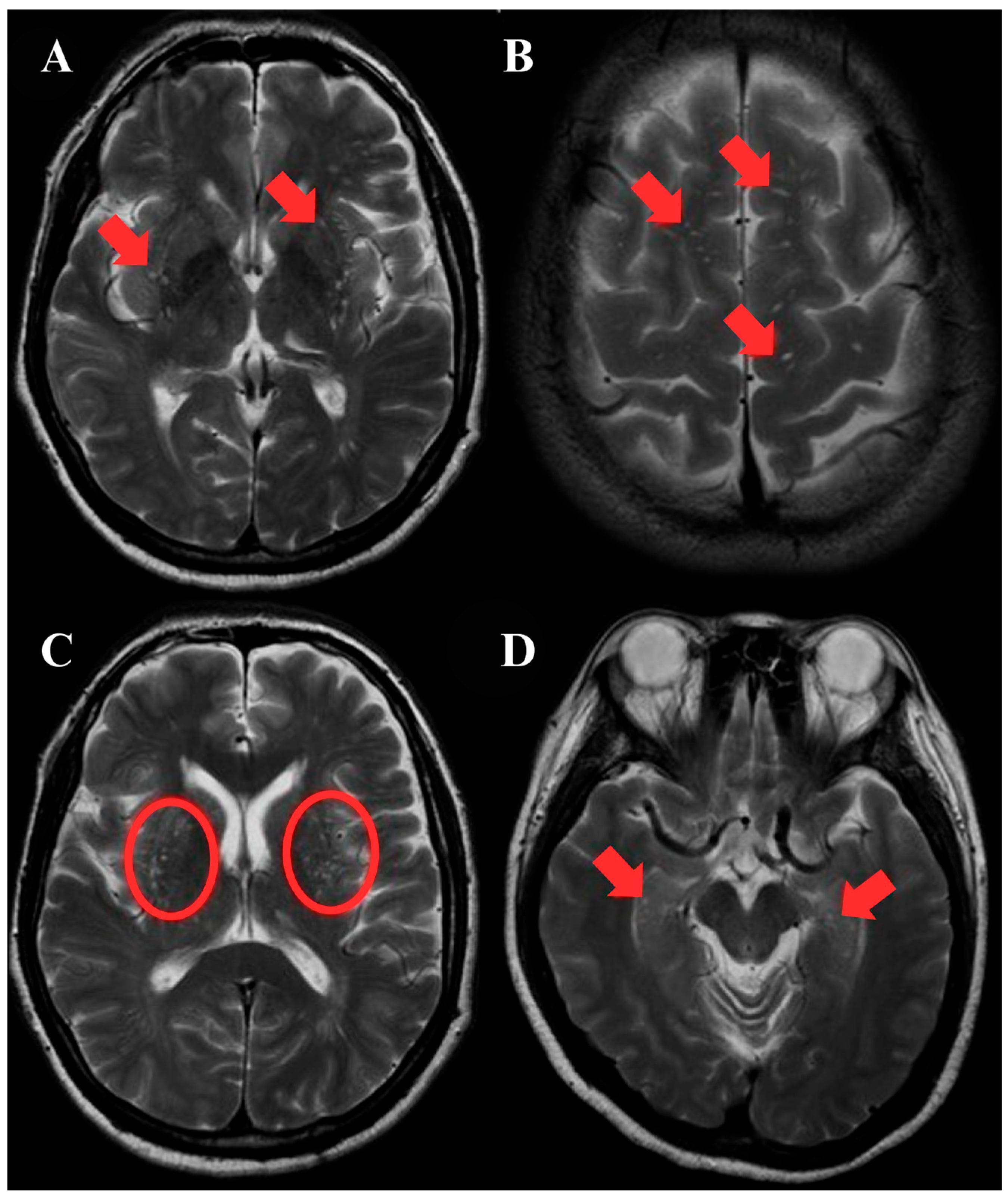 Jcm 14 06039 g002 Jcm 14 06039 g002