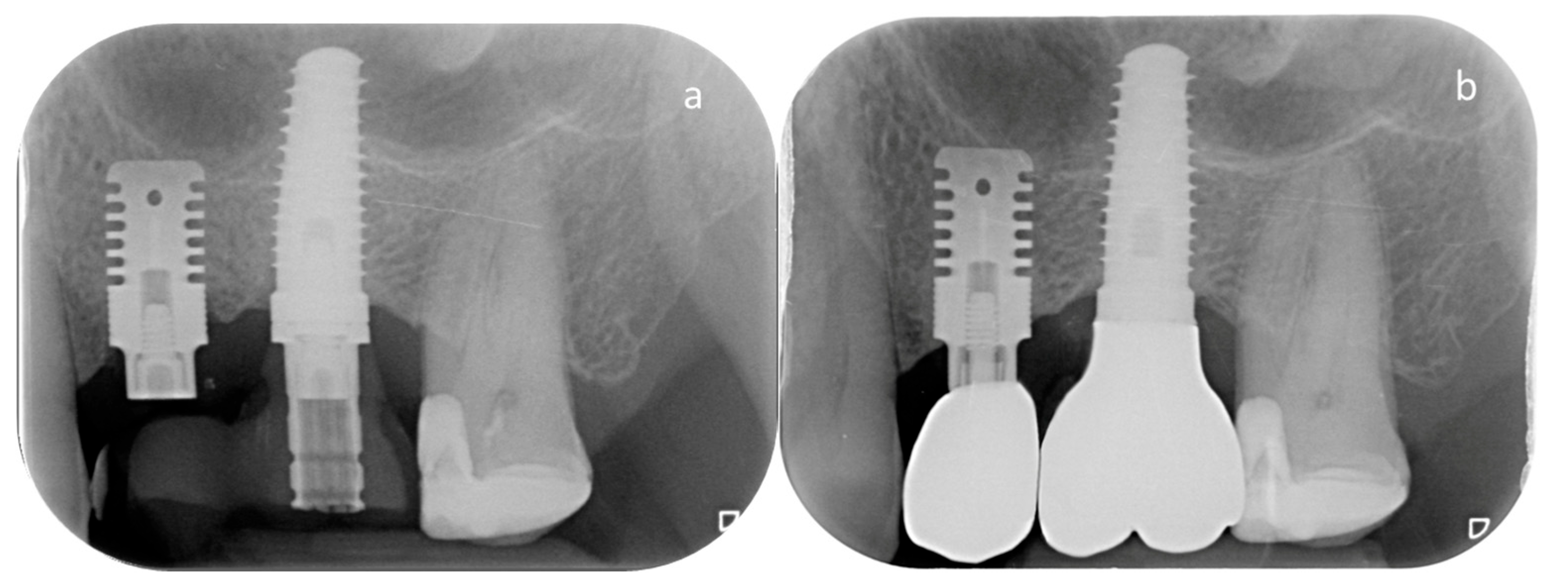 Jcm 14 06299 g002 Jcm 14 06299 g002