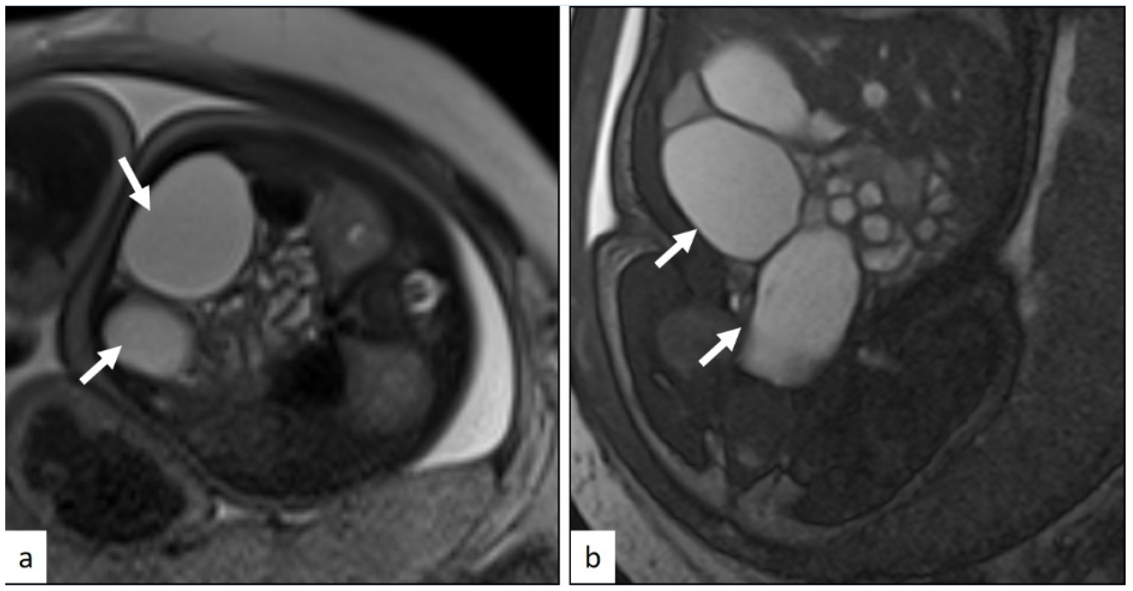 Jcm 14 06690 g003 Jcm 14 06690 g003