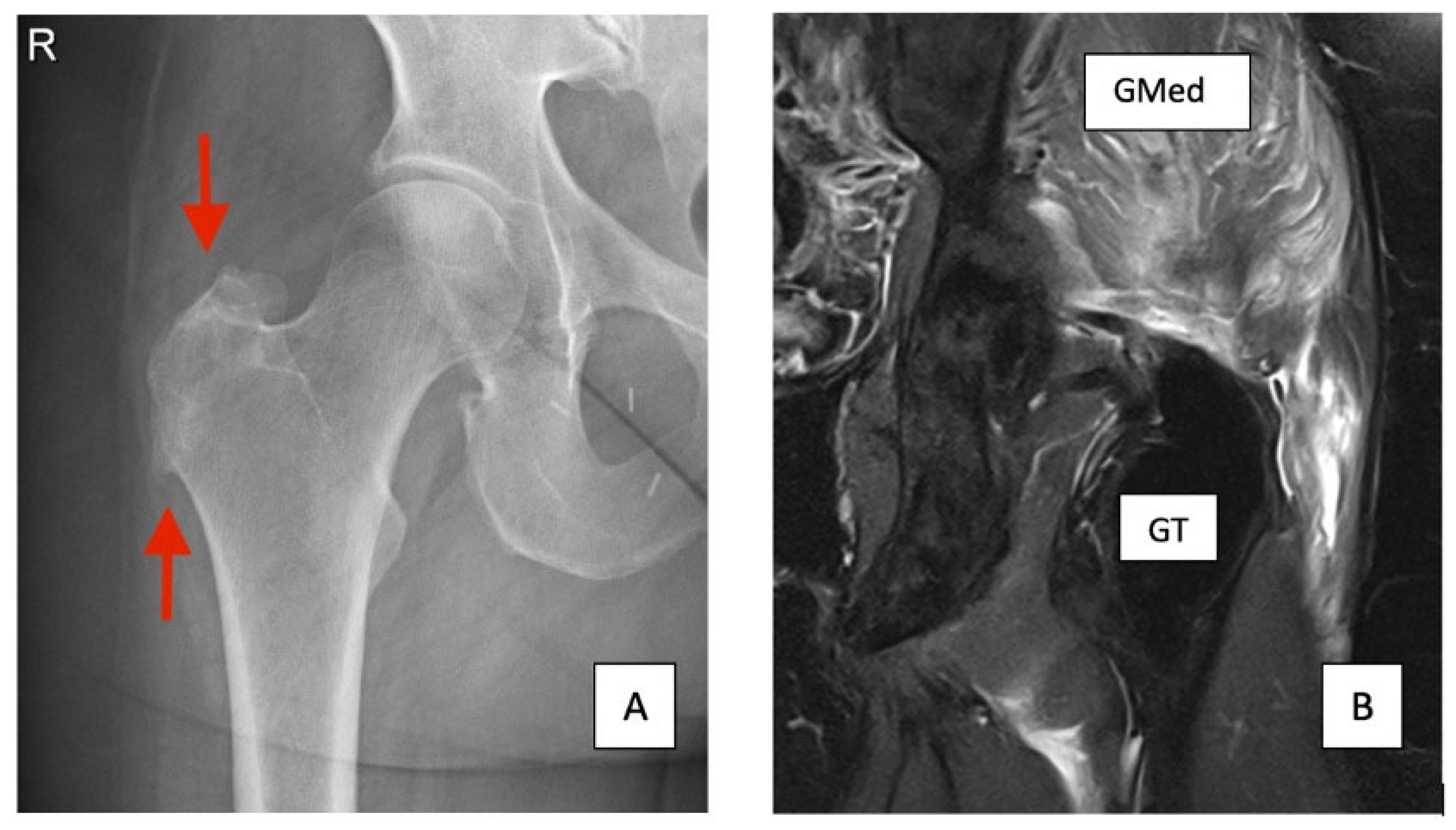 Jcm 14 06714 g001 Jcm 14 06714 g001