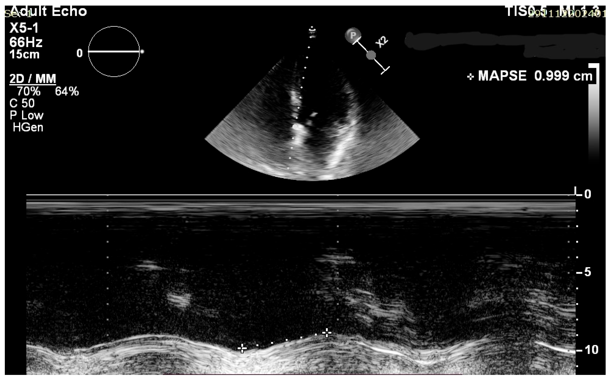Jcm 14 06880 g002 Jcm 14 06880 g002