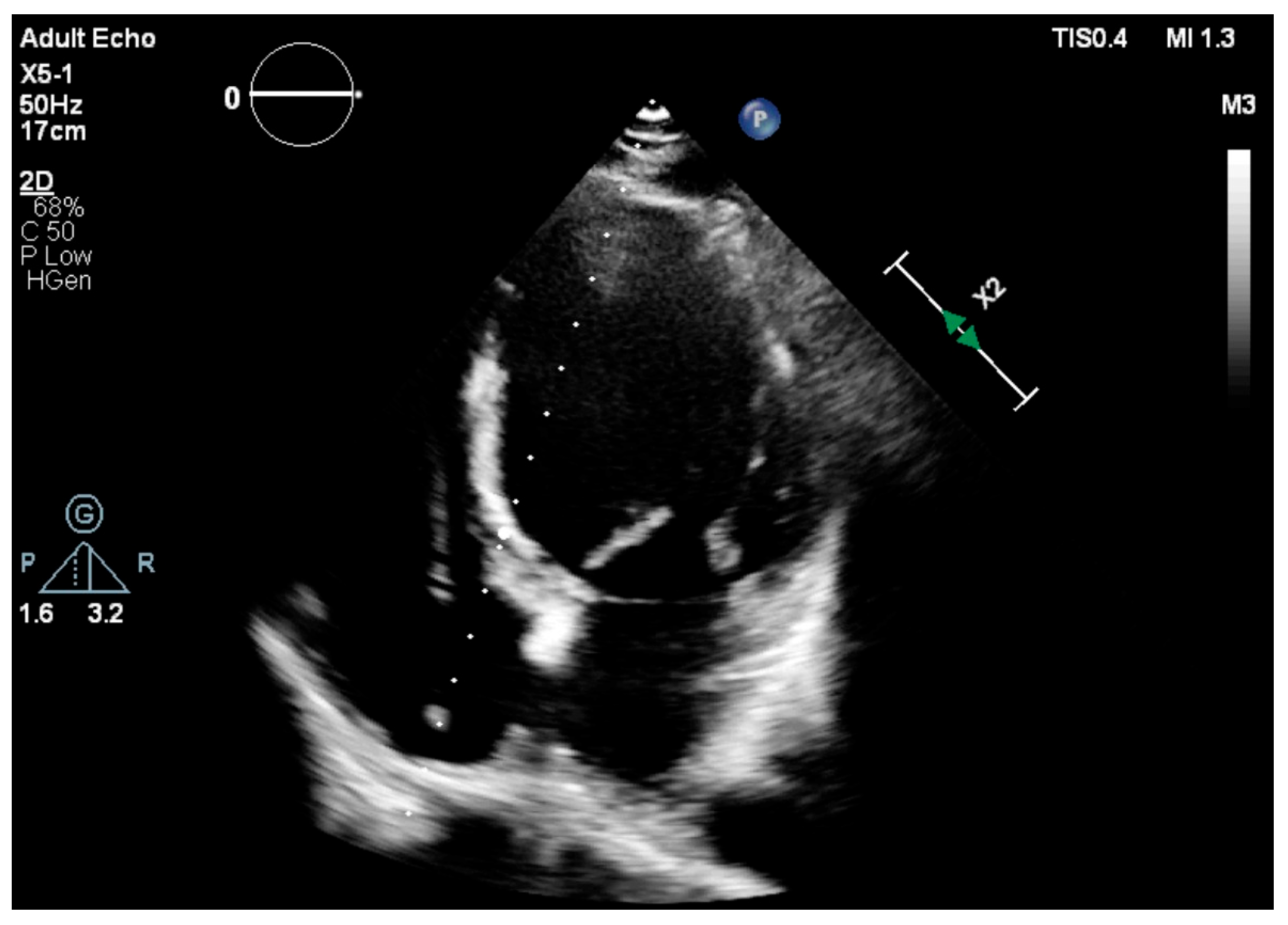 Jcm 14 06880 g003 Jcm 14 06880 g003